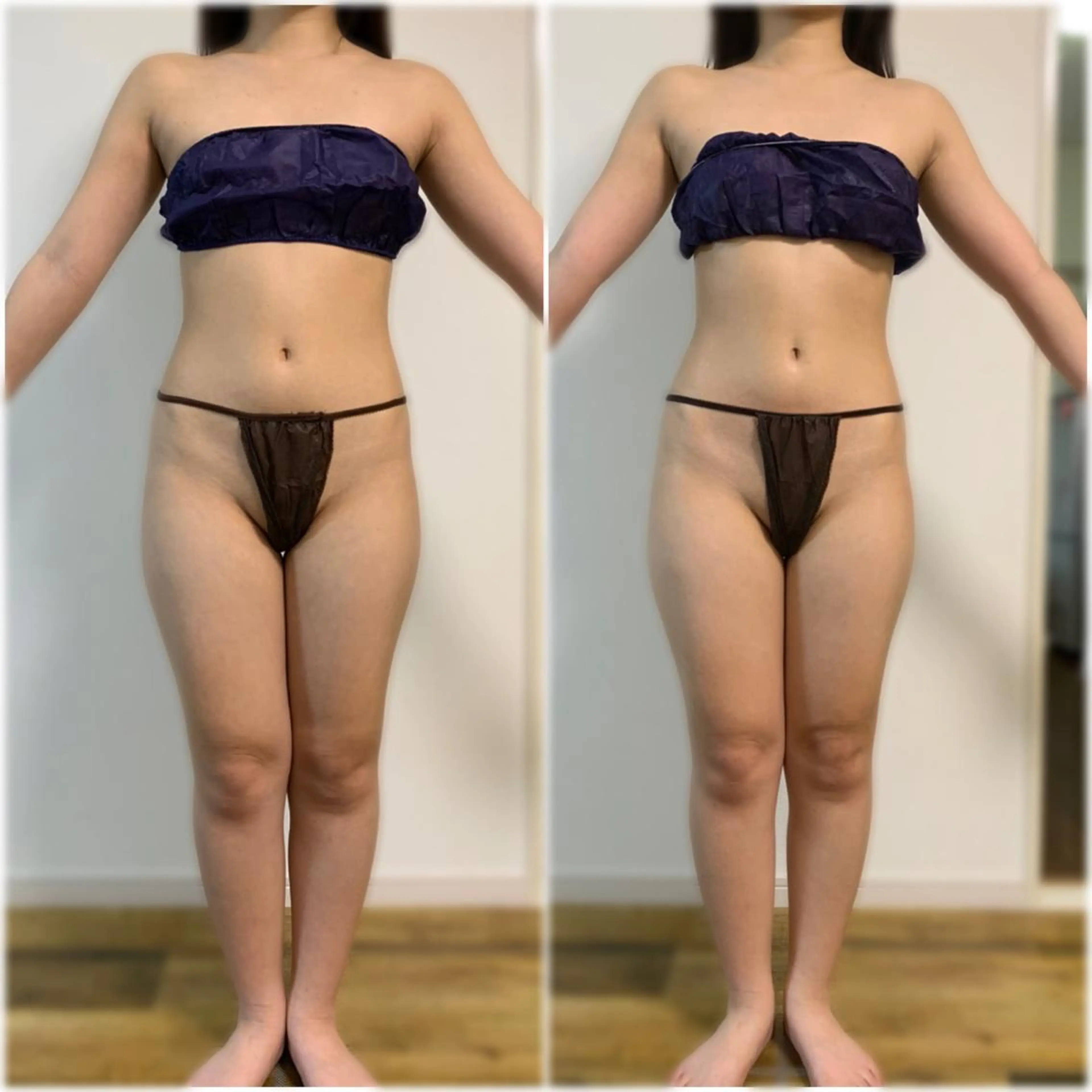 Linomalie エステ/たるみ/脱毛のエステ・リラクイメージ