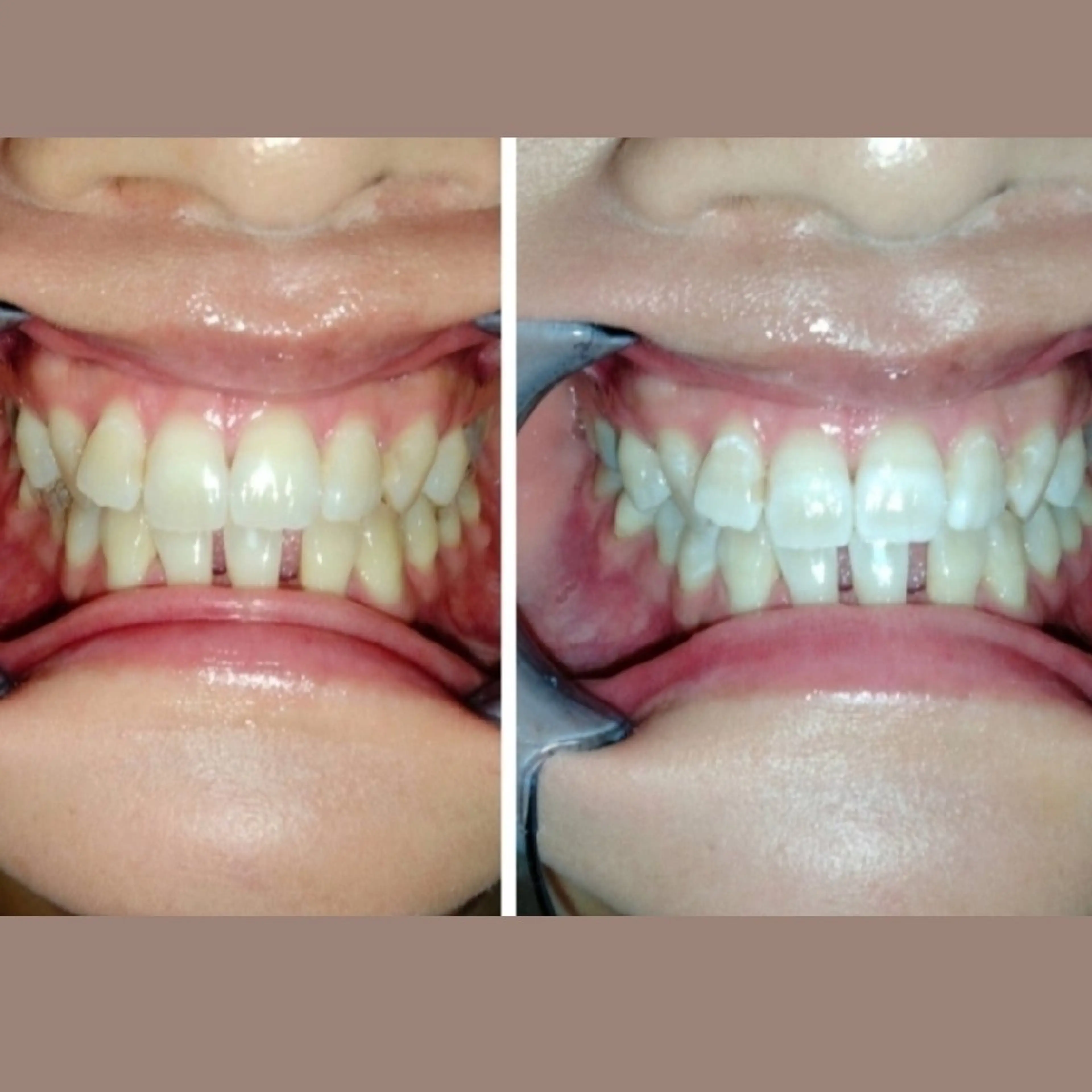 エステ A-family  kaoriのエステ・リラクイメージ