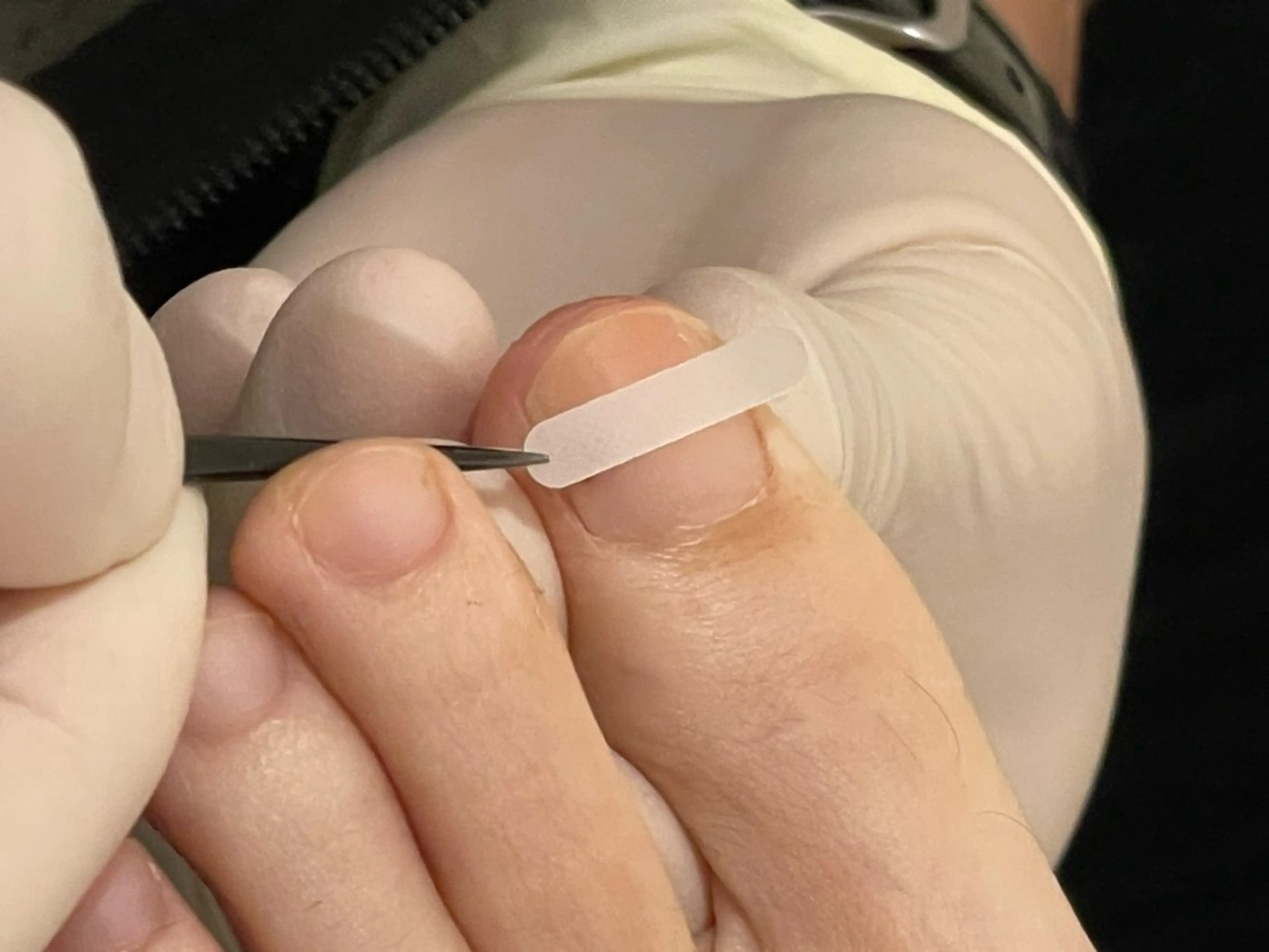 その他 日本巻き爪センター 渋谷院のエステ・リラクイメージ