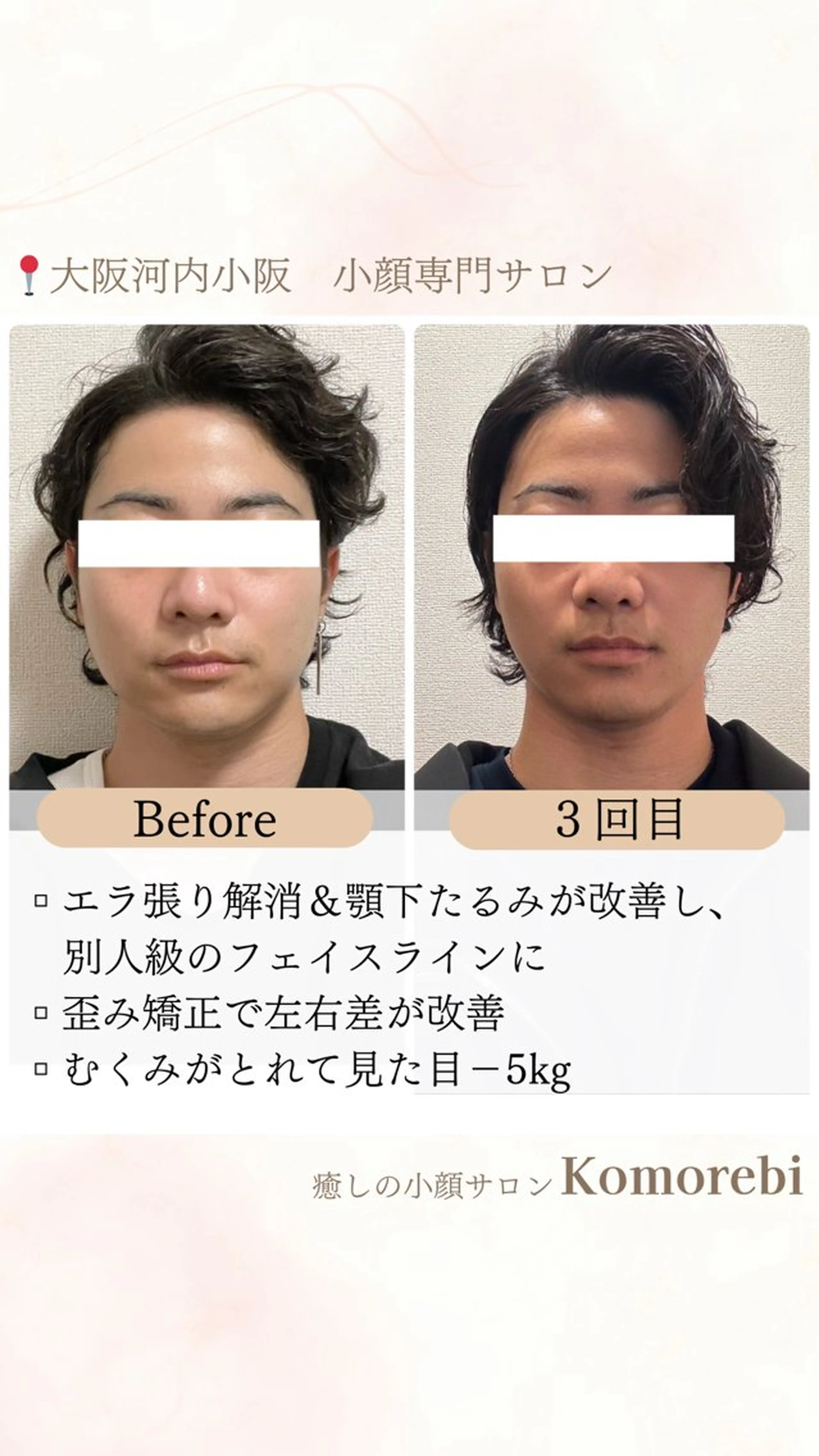 営業電話❌小顔サロン Komorebiのエステ・リラクイメージ