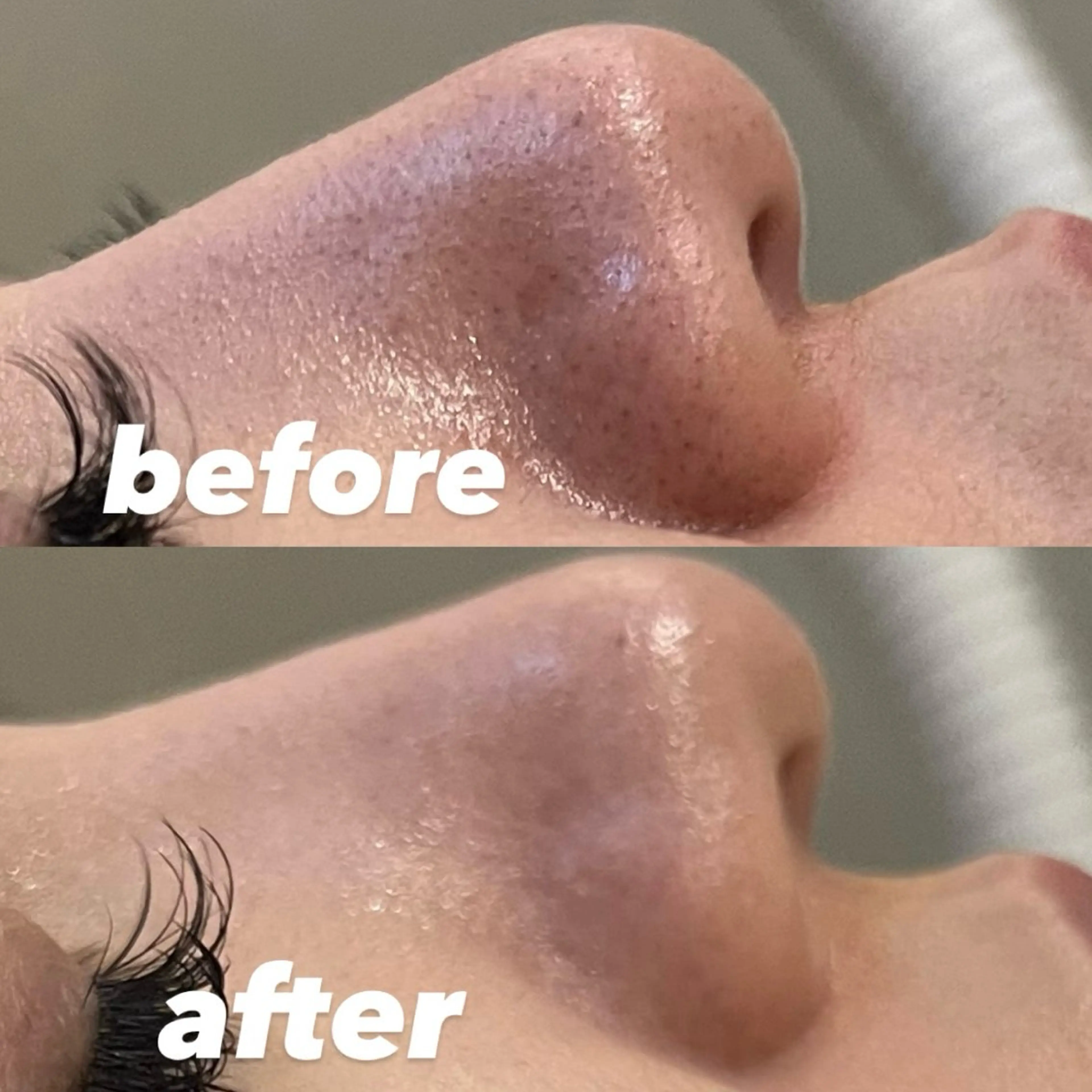 エステ リラク 肌管理サロン vidyto　MOEのエステ・リラクイメージ