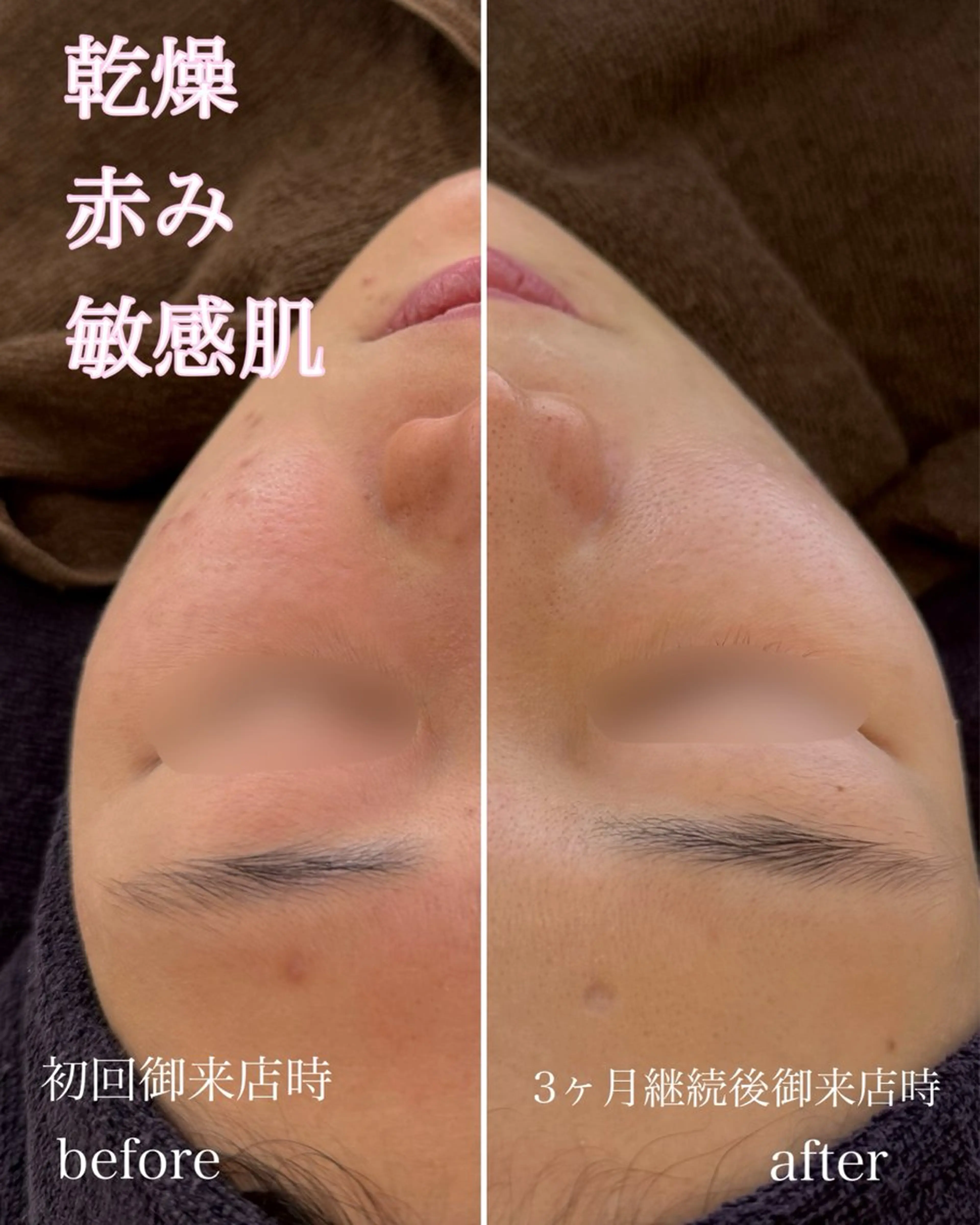 エステ yukiko/美容師 肌質改善/中崎町のエステ・リラクイメージ