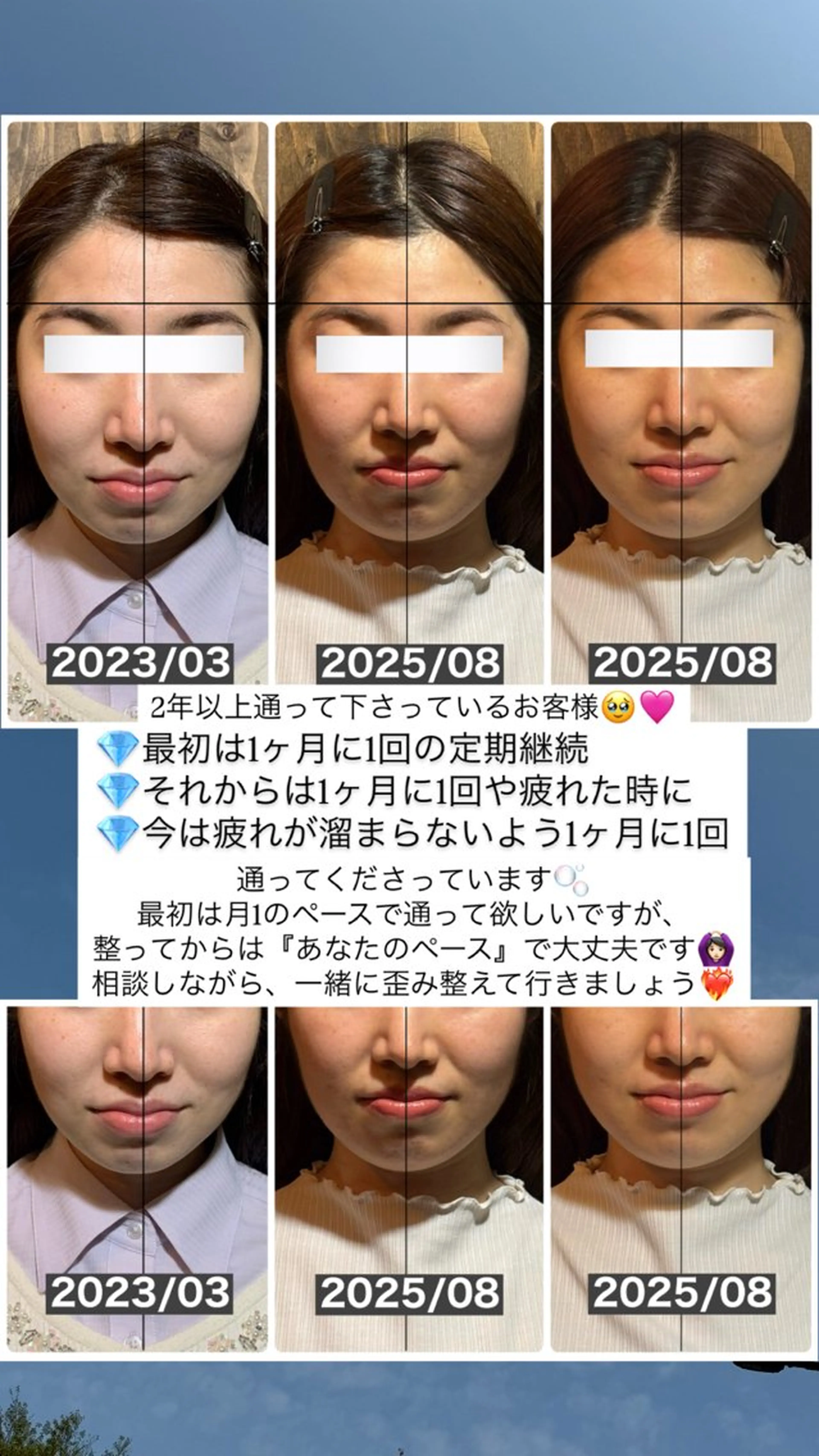 エステ リラク 💎後悔させない小顔 矯正💎イトヤマ🌱のエステ・リラクイメージ