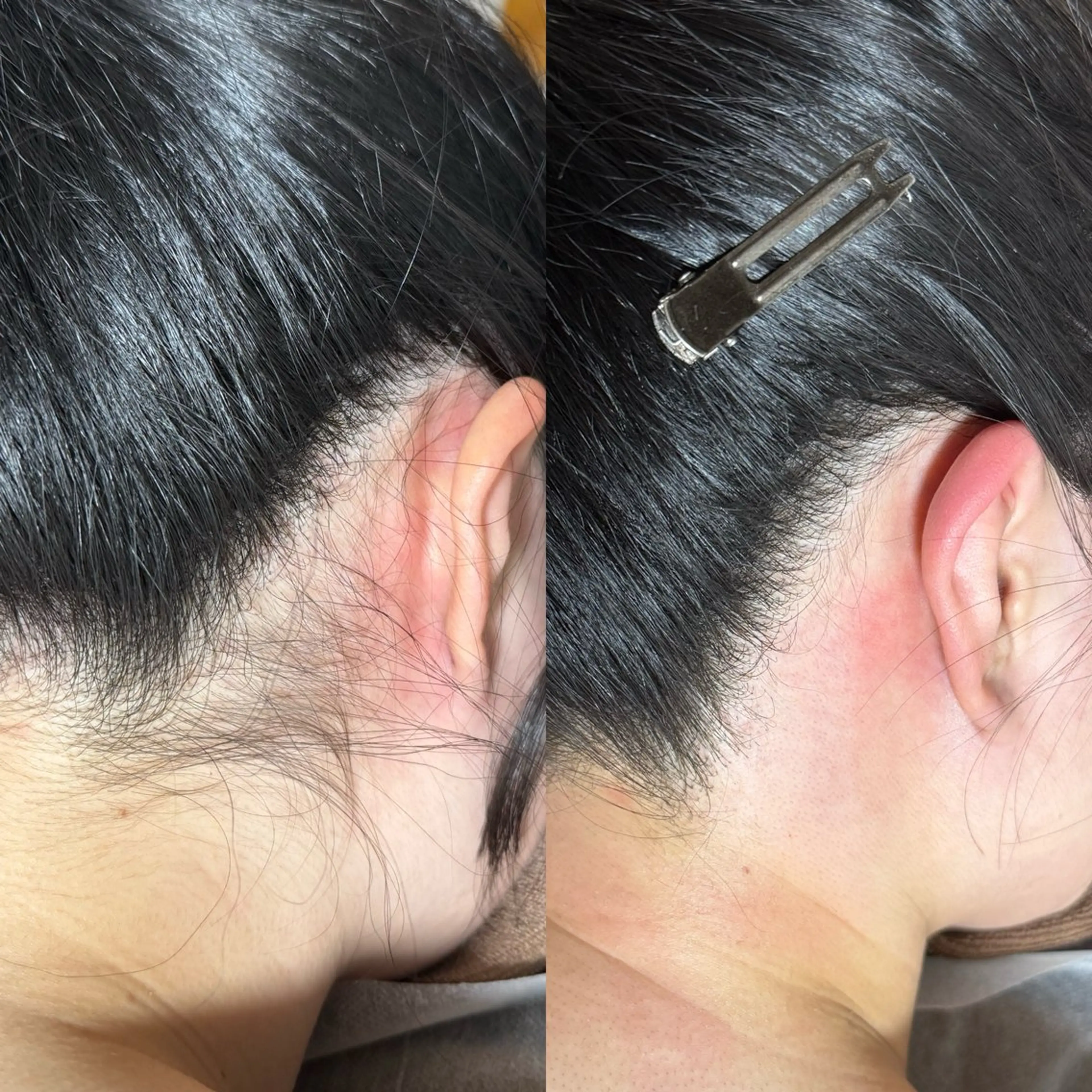 脱毛 六本木脱毛andS 店長Sachiのエステ・リラクイメージ