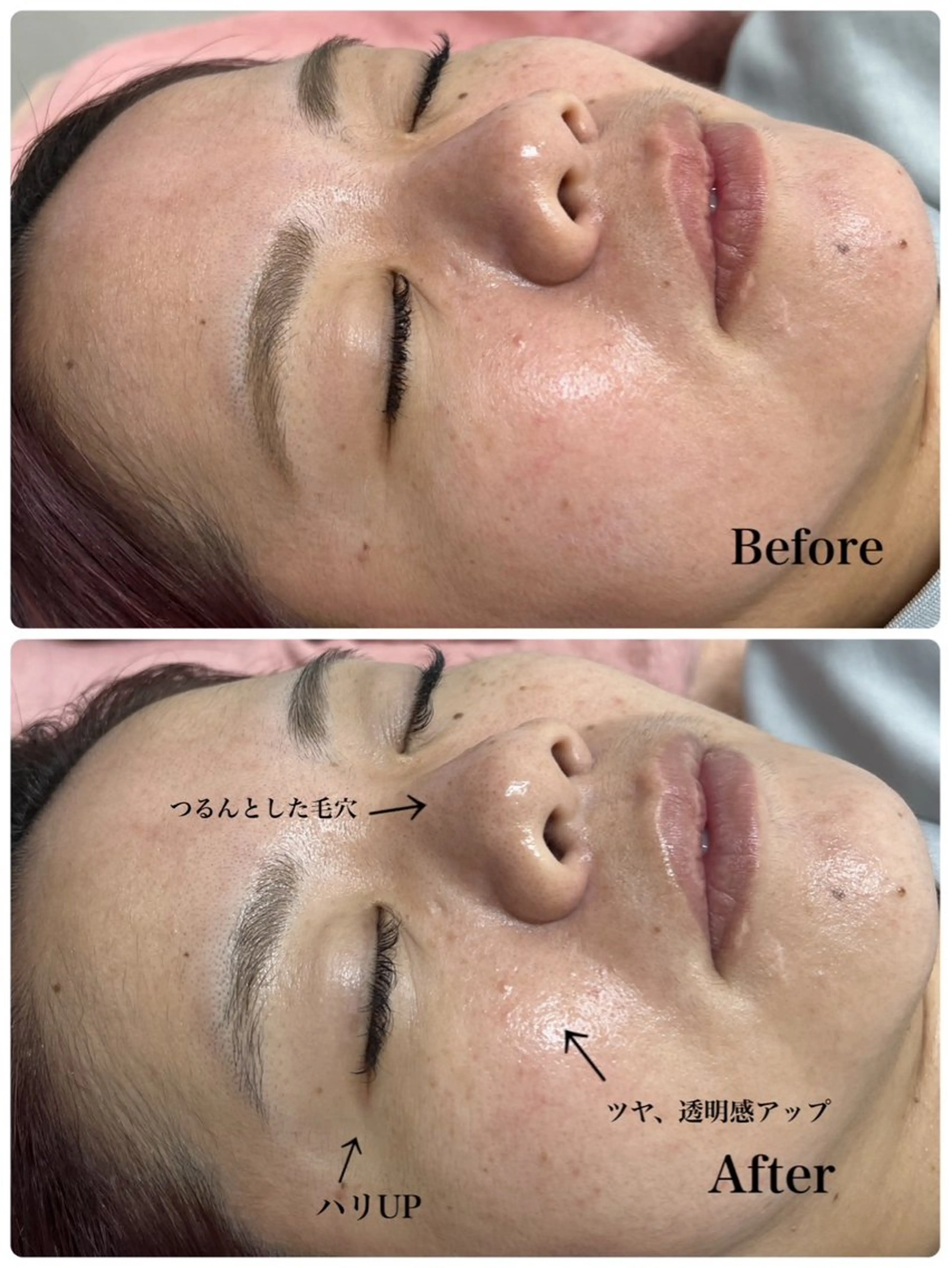 エステ Astorie 相模大野エステのその他イメージ