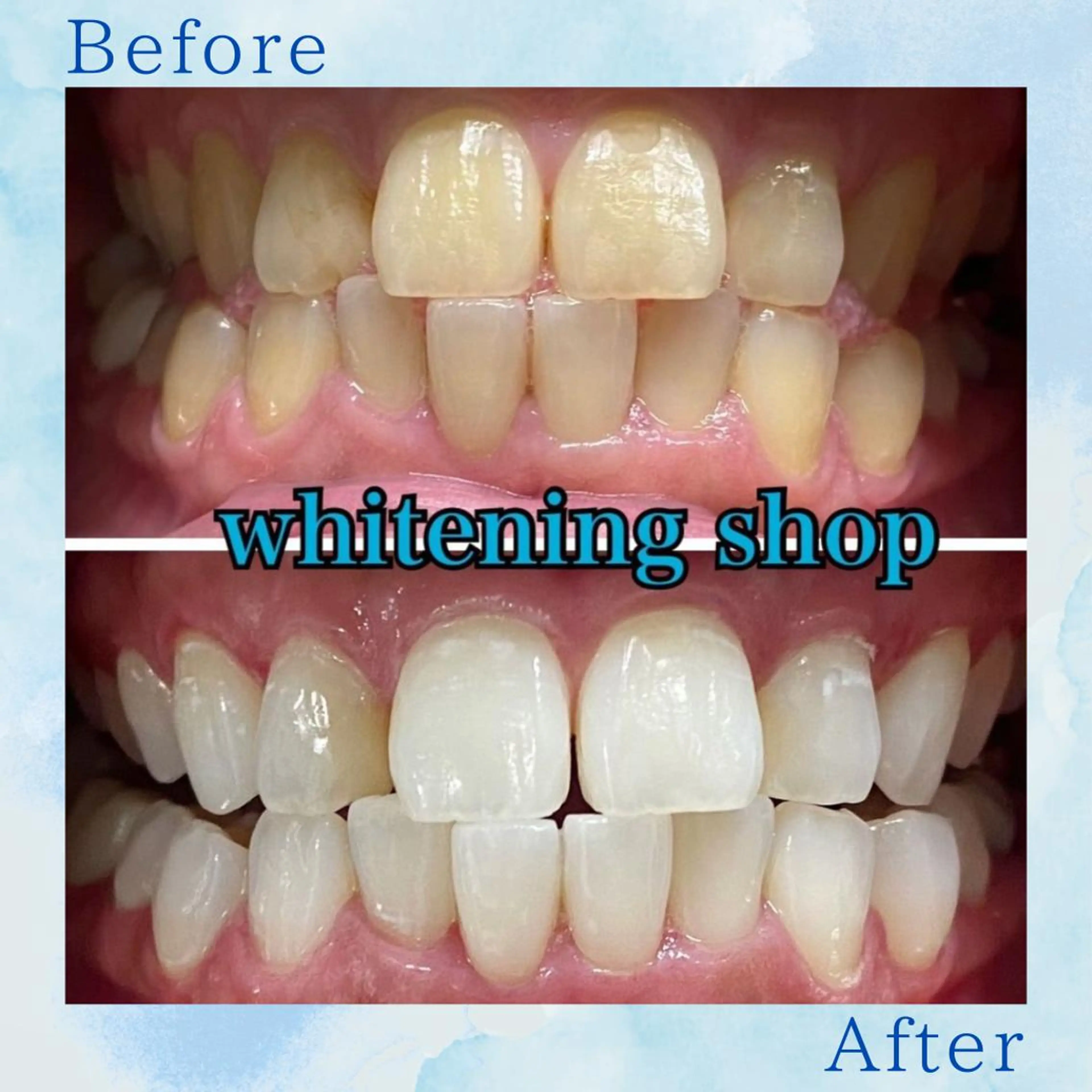 その他 ホワイトニング ショップ葛西店のその他イメージ