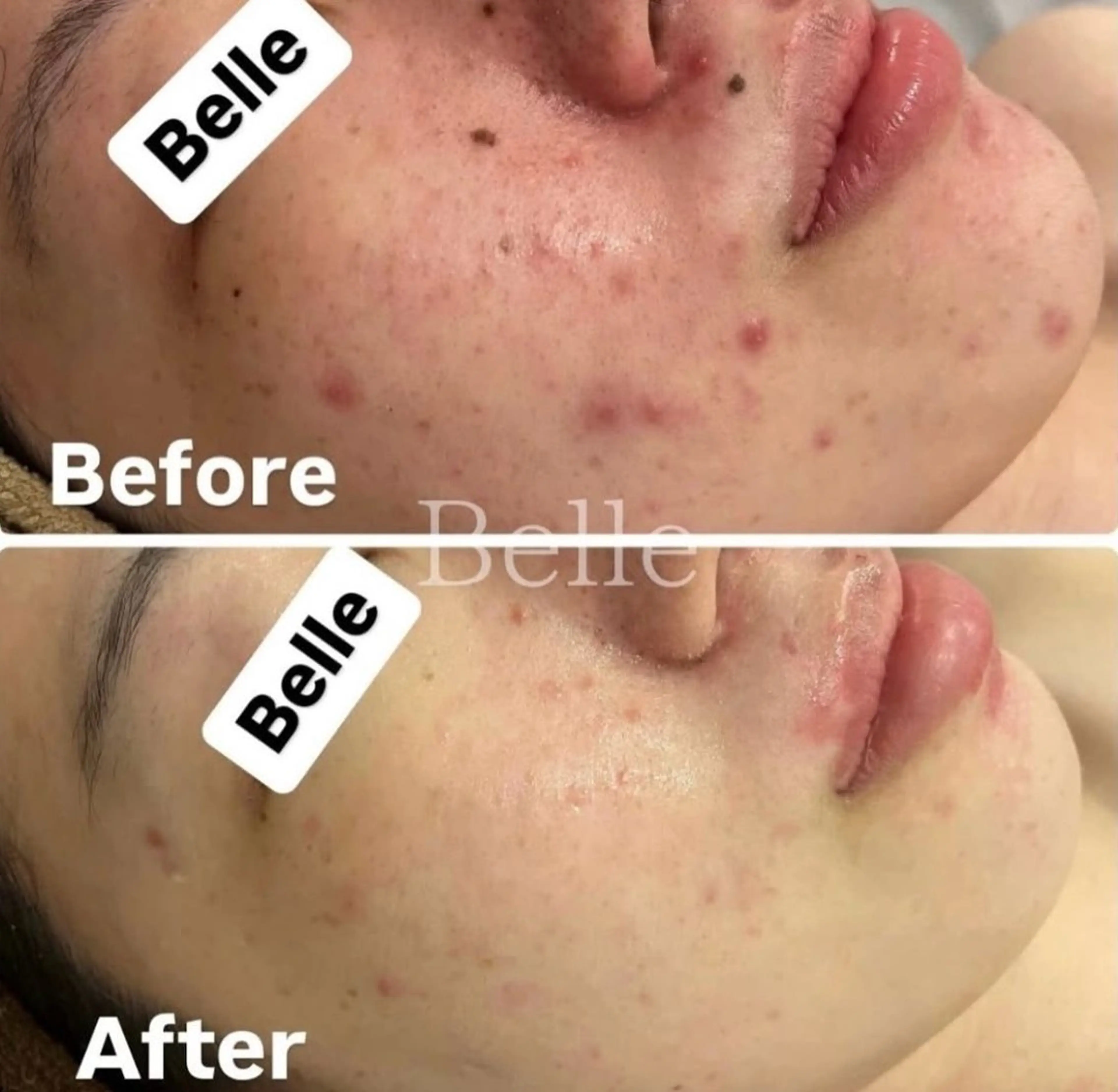 Belle原宿所属・佐藤 加奈のエステ・リラクイメージ