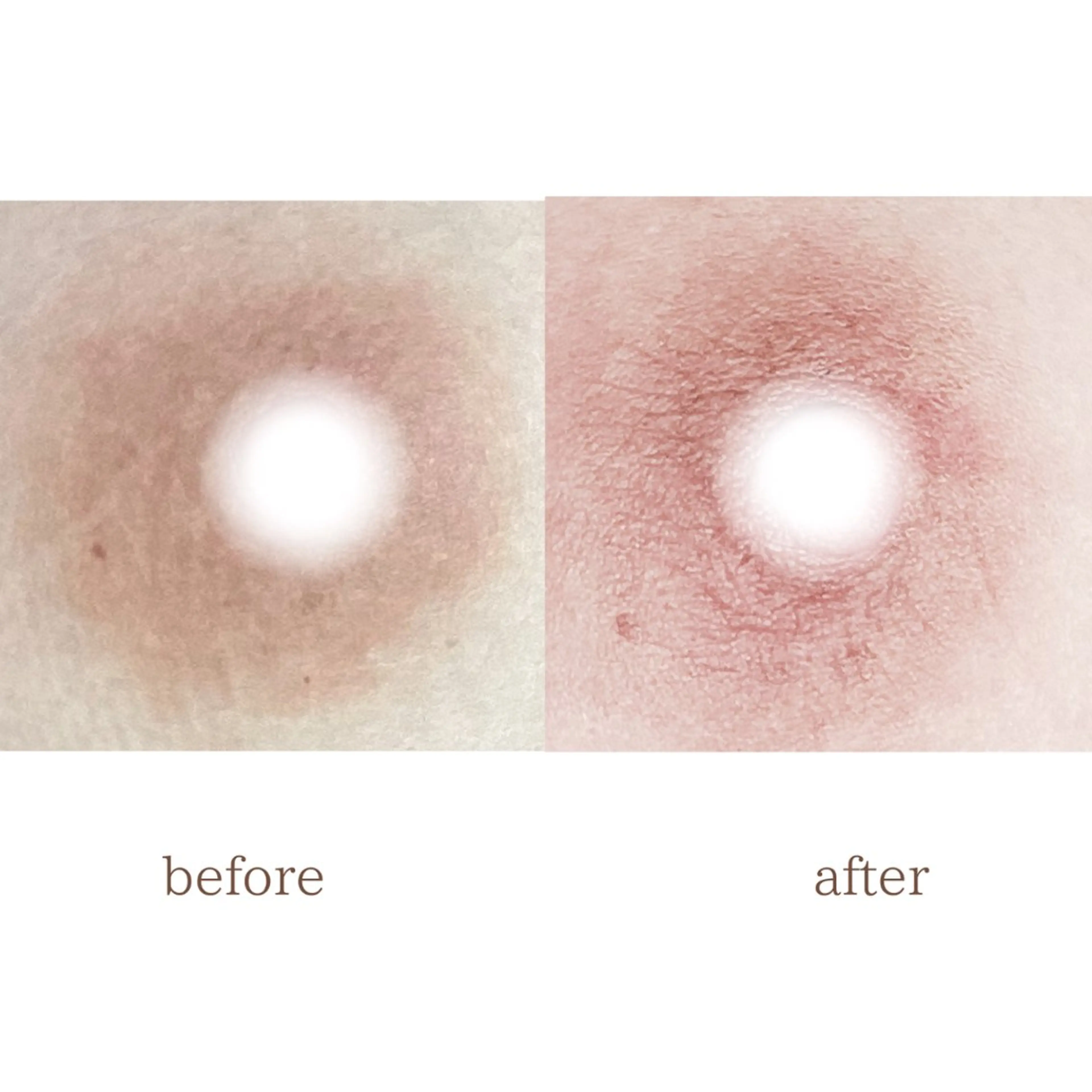 小顔/たるみ/黒ずみ除去専門サロン/SONA 大和西大寺店所属・【小顔痩身専門看護師 サロンSONA】のエステ・リラクイメージ