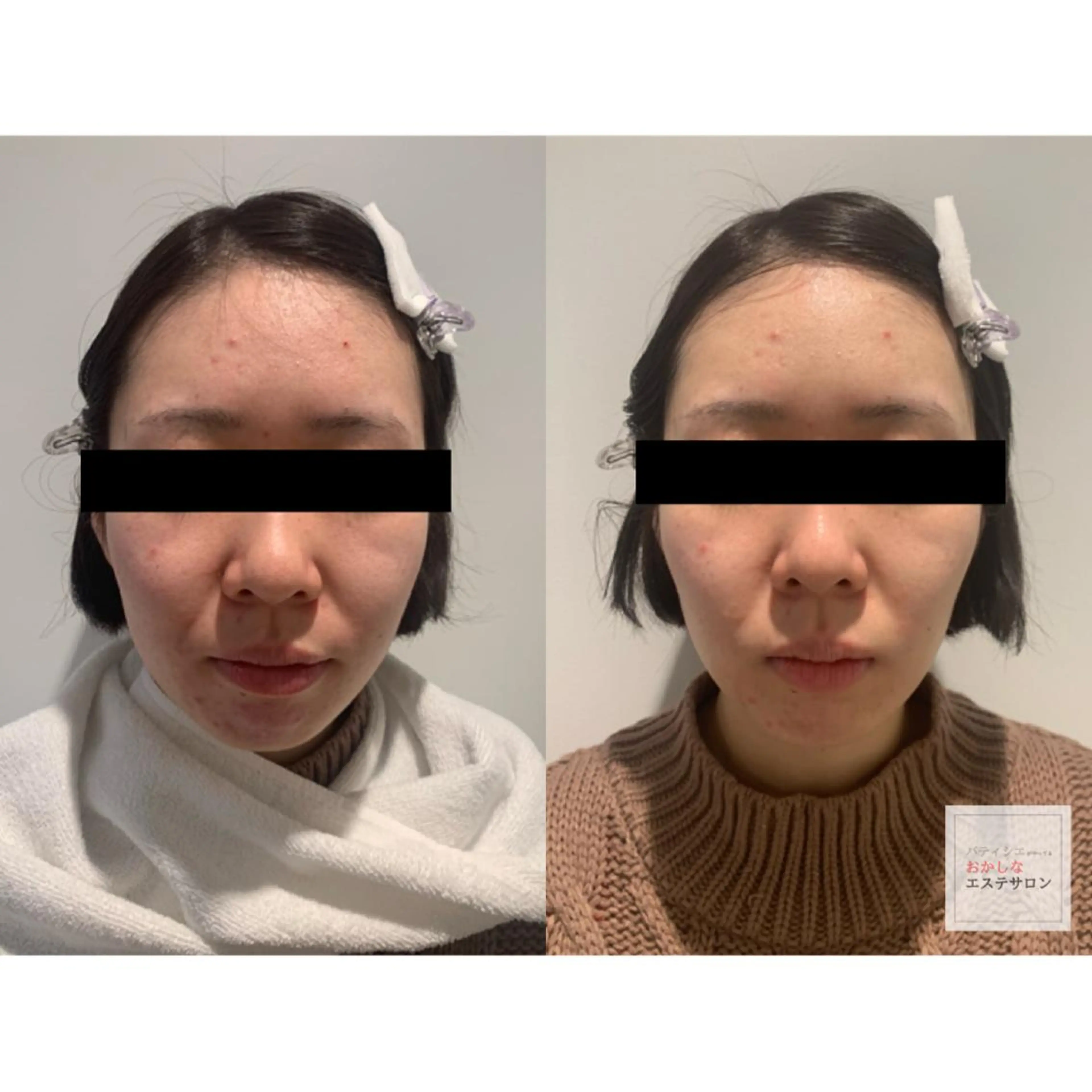 メンズ プライベートサロン Ari33nailのネイルデザイン