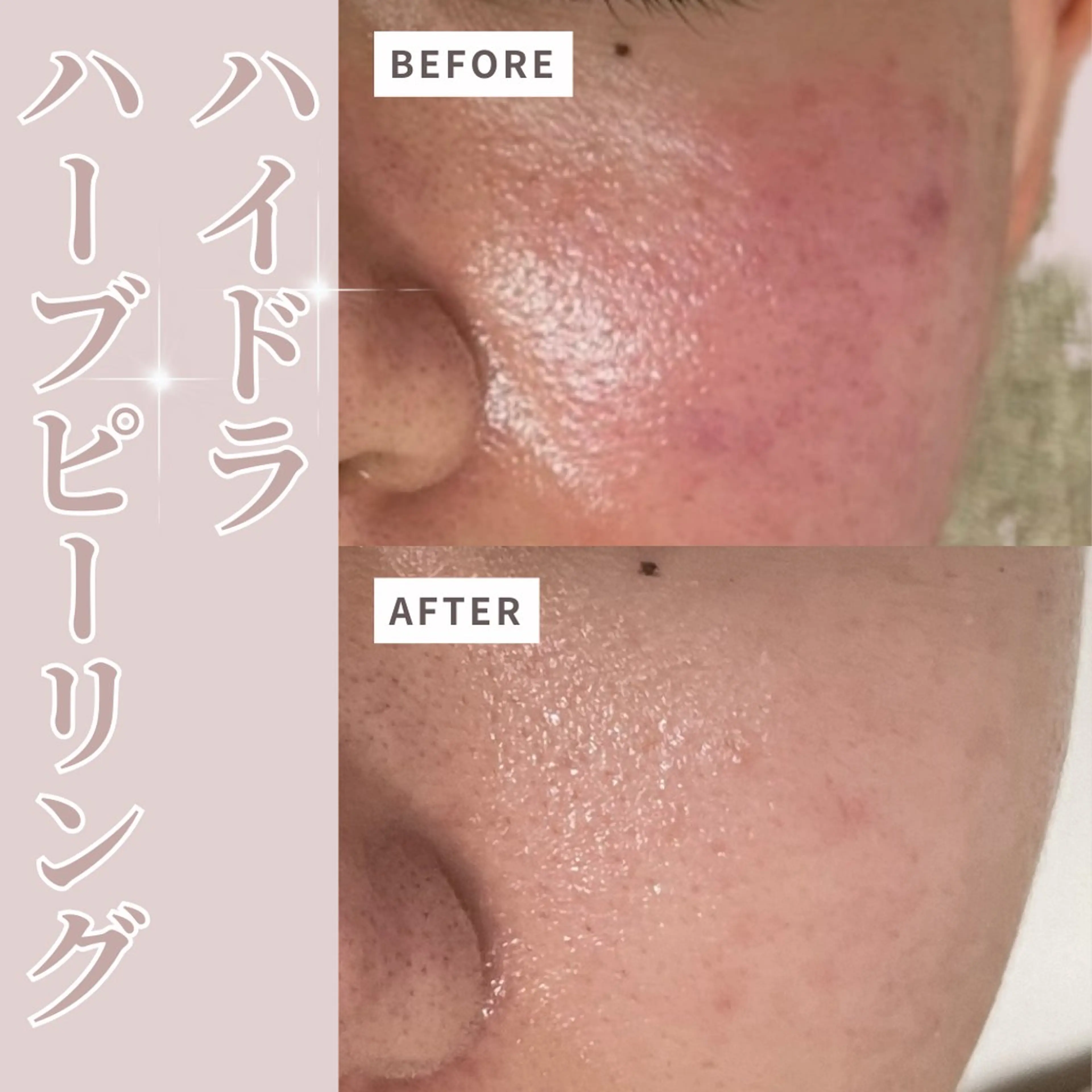 エステ プライベートサロン Belle（ベル）のエステ・リラクイメージ