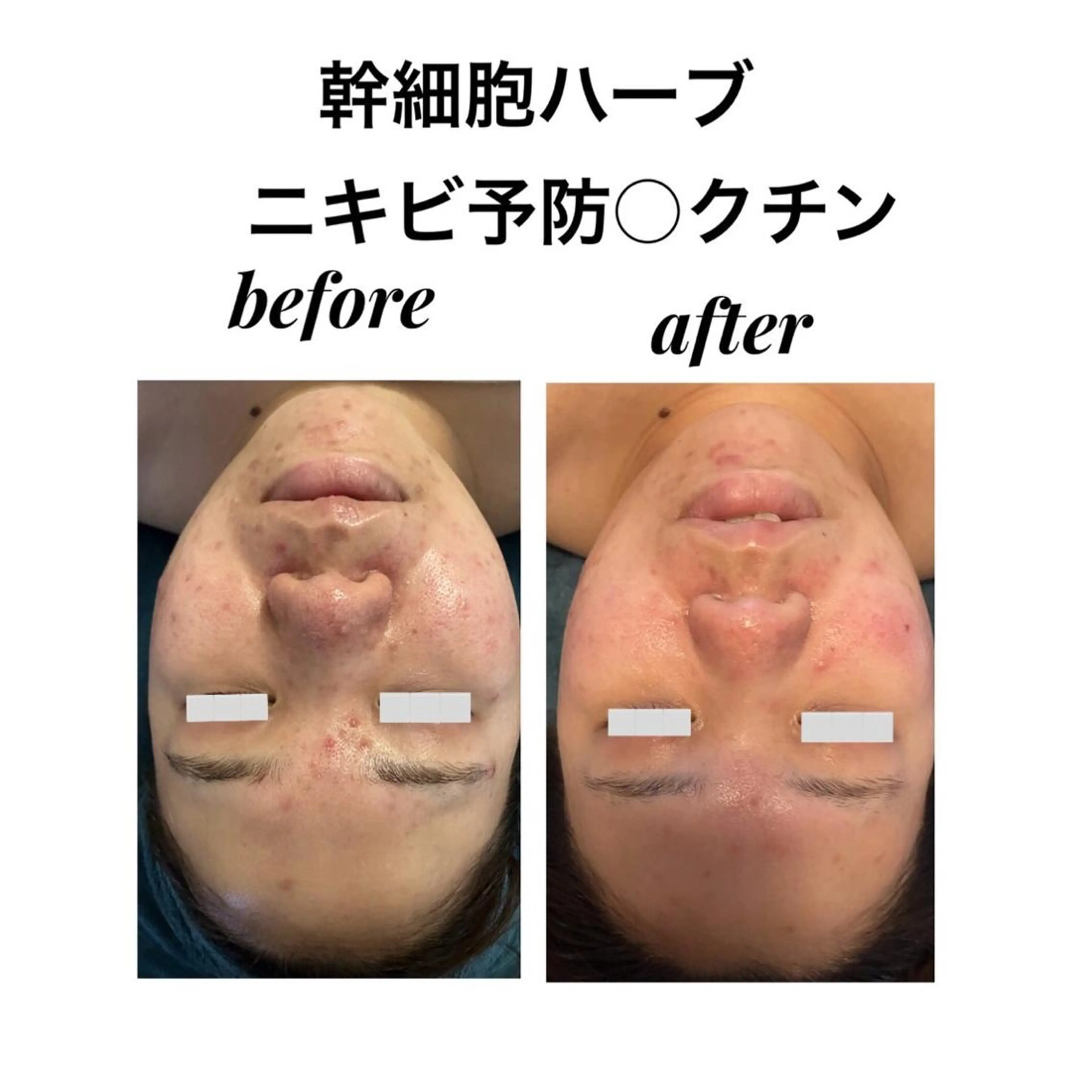 その他 Dione湘南藤沢店 ×LUANA　齋藤のエステ・リラクイメージ