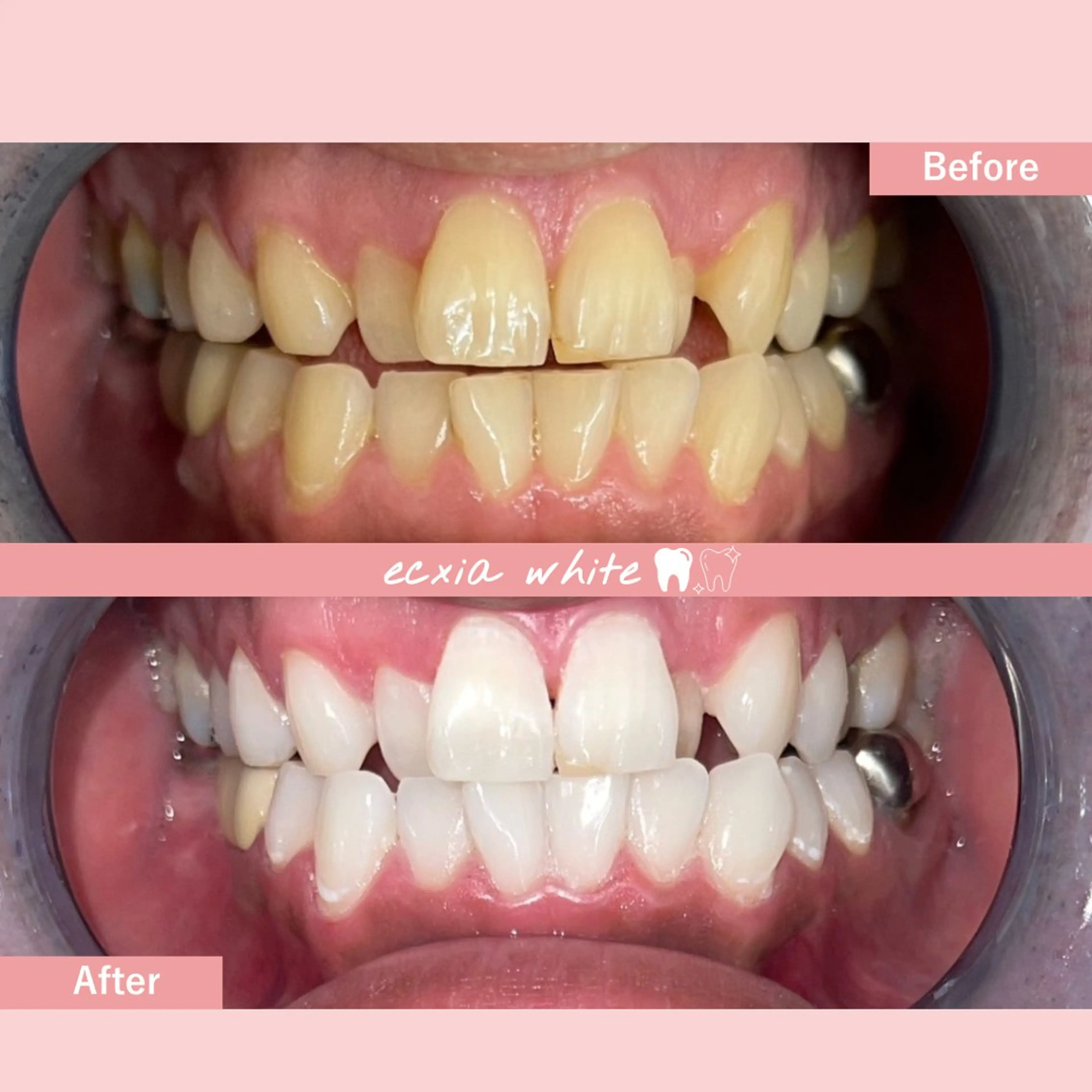 セルフホワイトニング エクシア札幌琴似店のその他イメージ