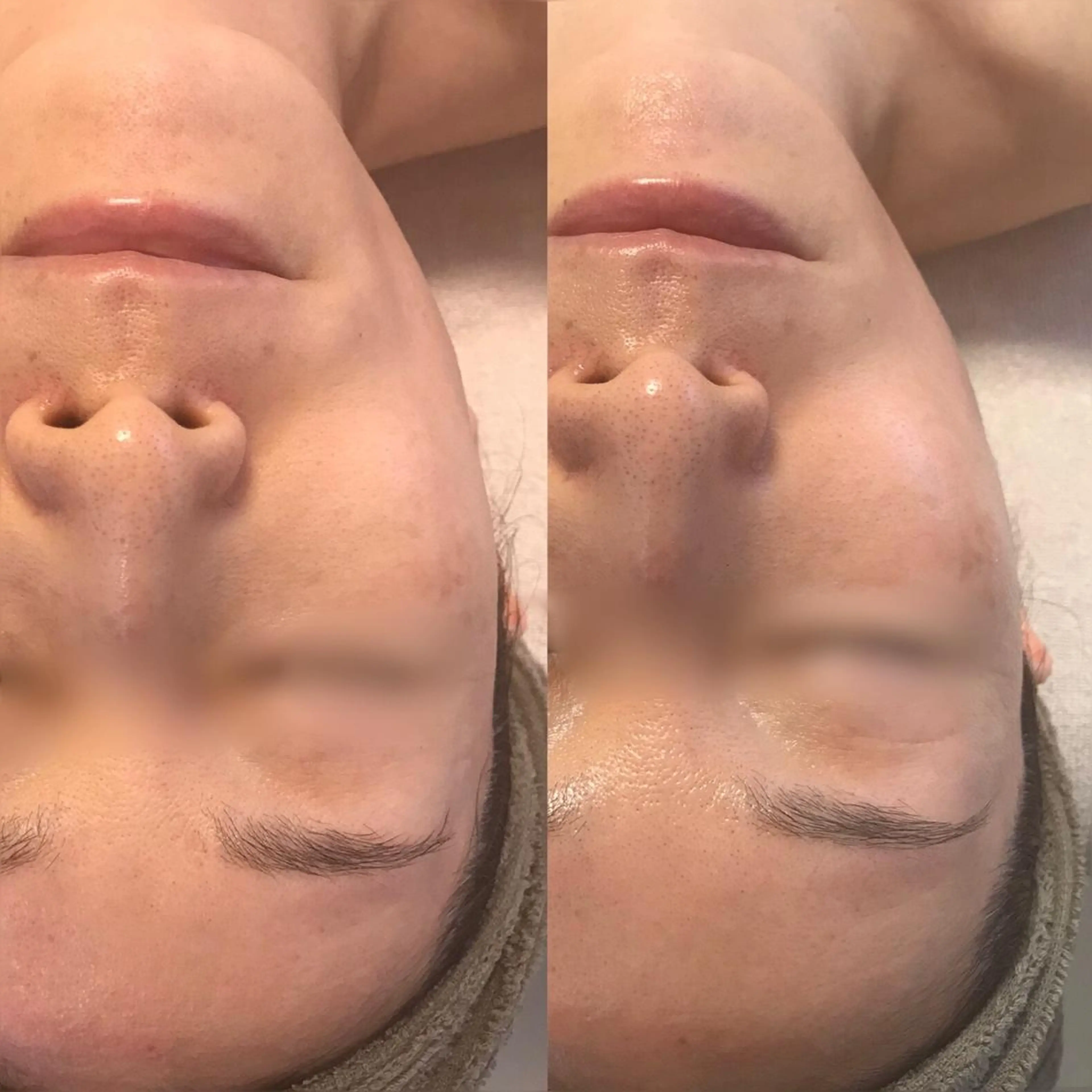 エステ 大名 Kalon（カロン）のエステ・リラクイメージ