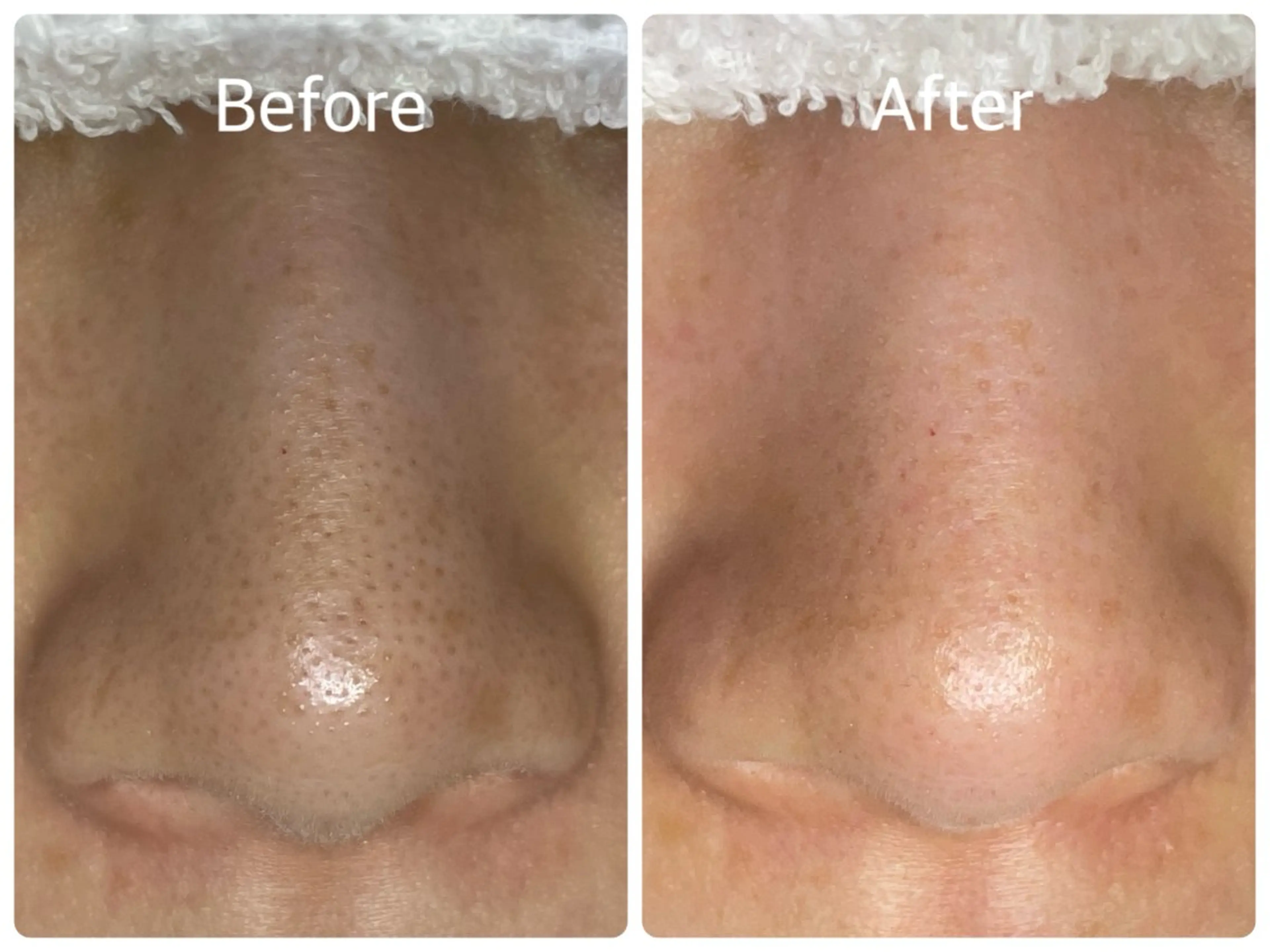 salon HATOのエステ・リラクイメージ