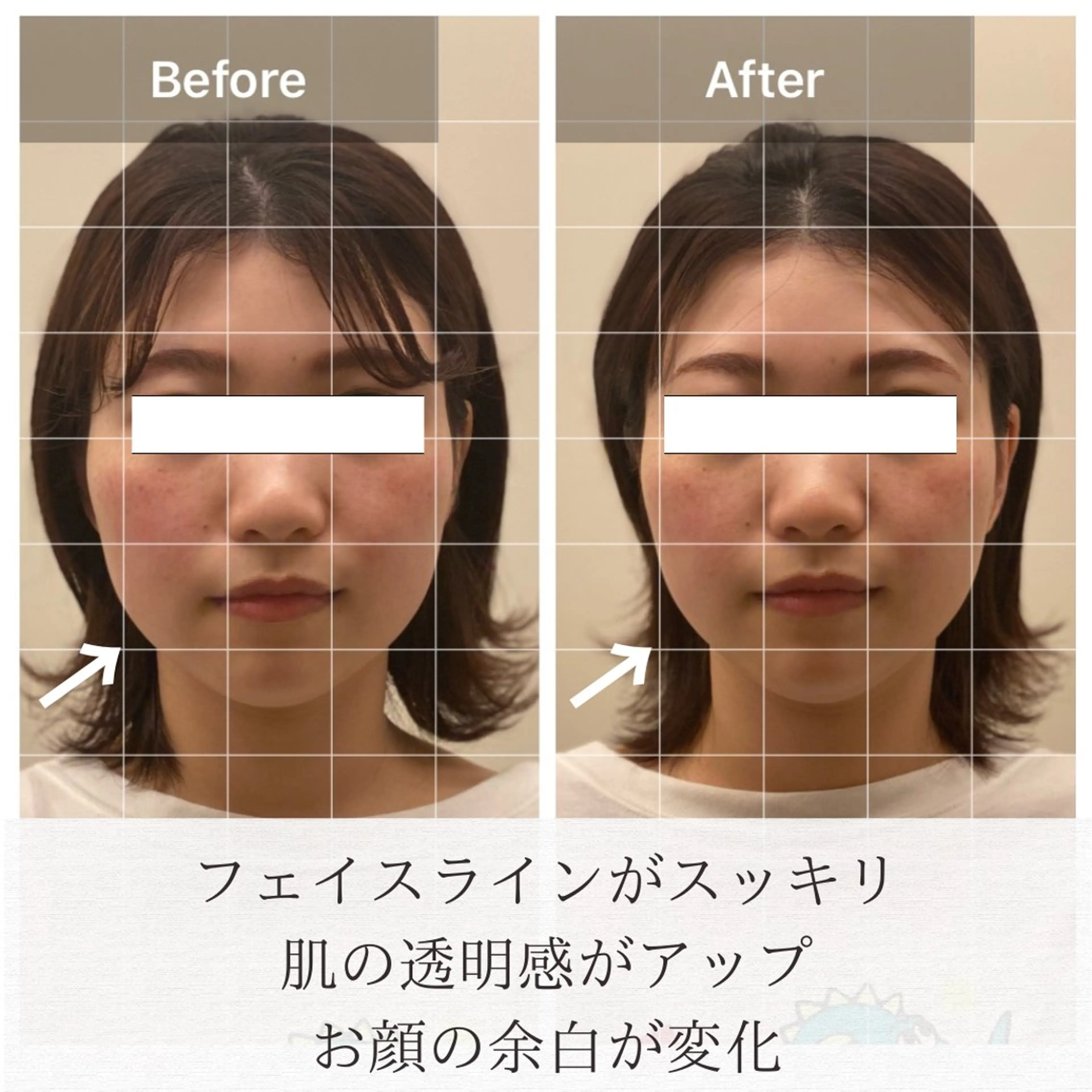 美容鍼/ヘッドスパ/ 💎さかもとのエステ・リラクイメージ