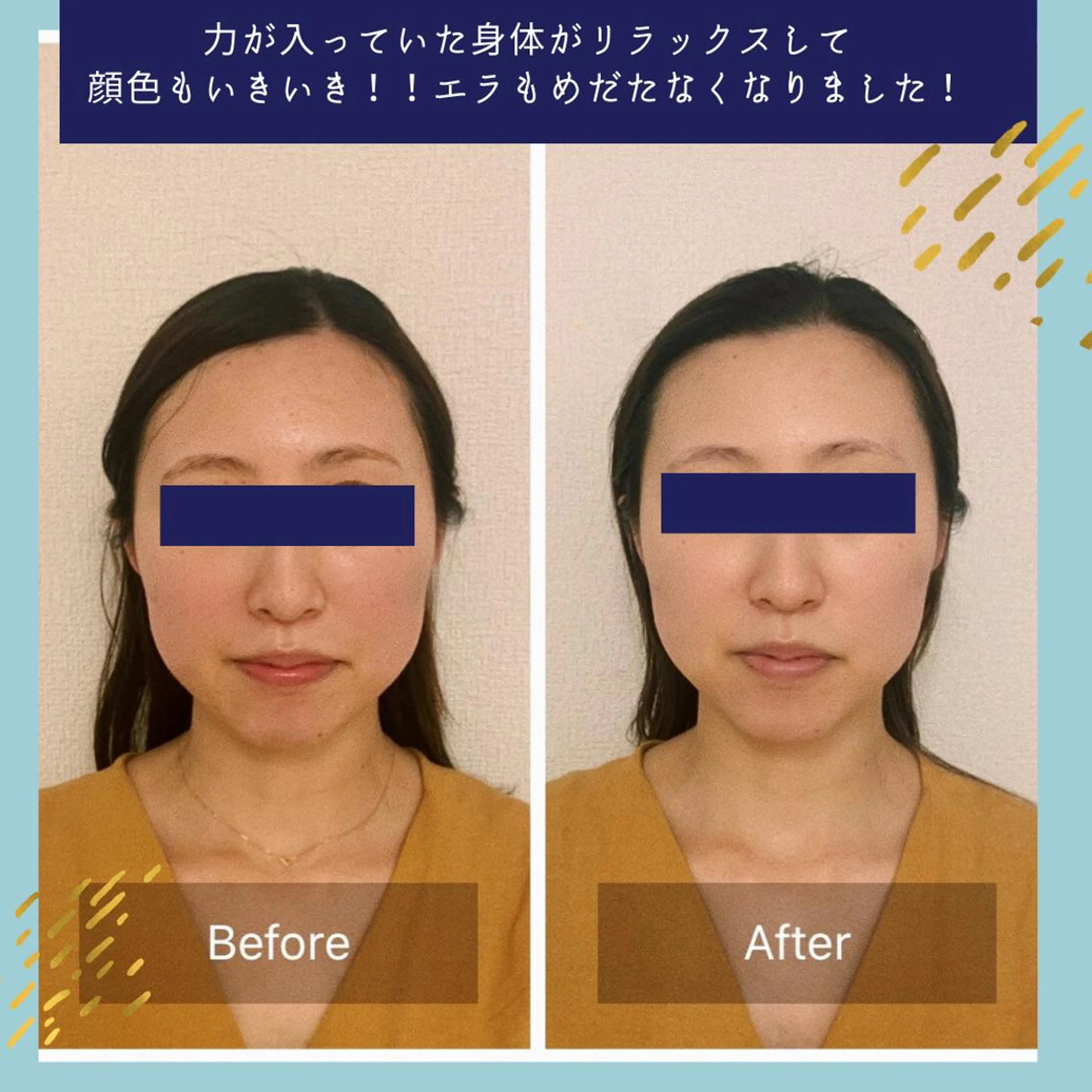 ielu〜毛穴ケア ハーブピーリングのエステ・リラクイメージ