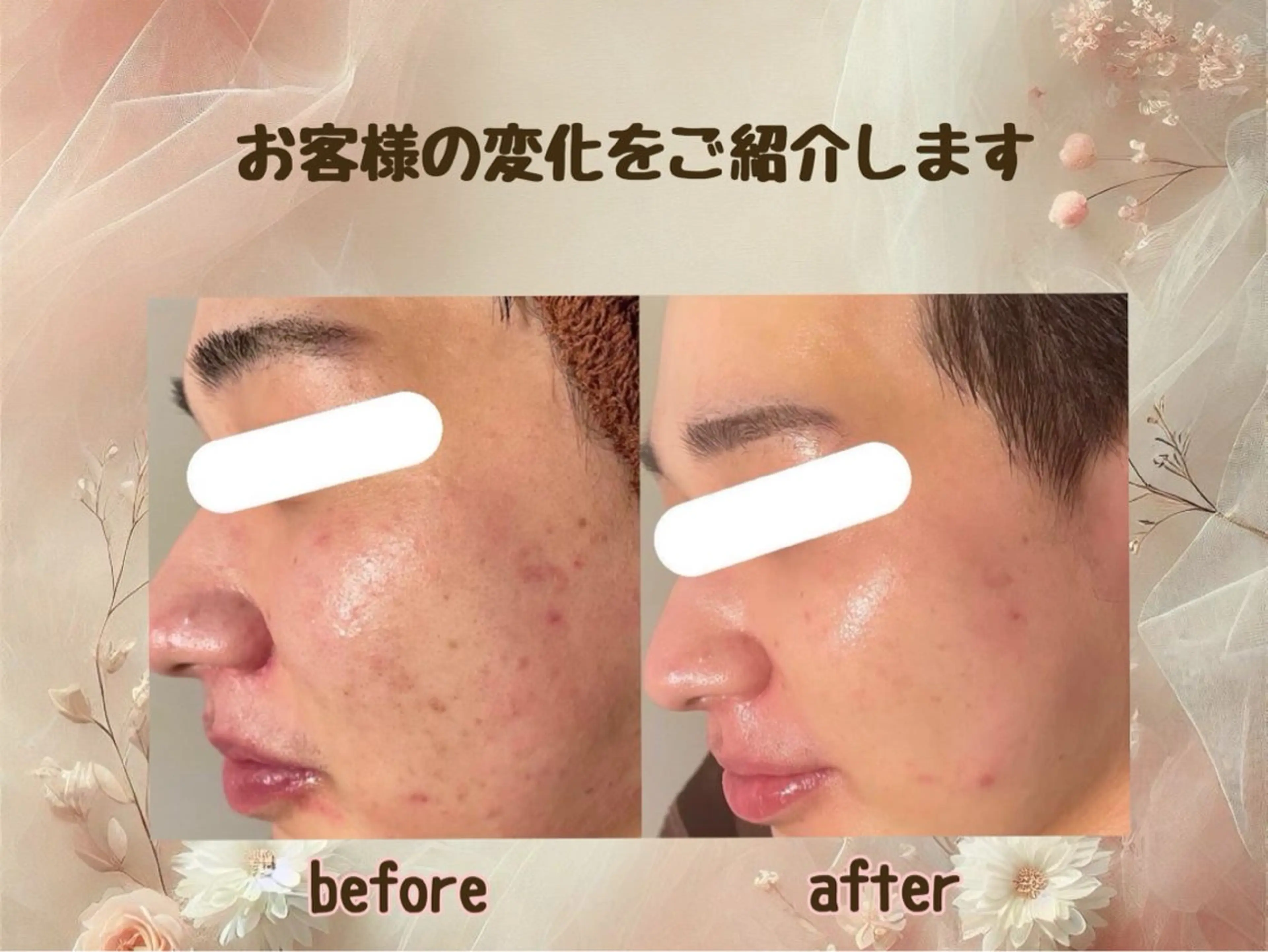 小顔矯正＆美肌サロン ブプラ大元駅前店のエステ・リラクイメージ