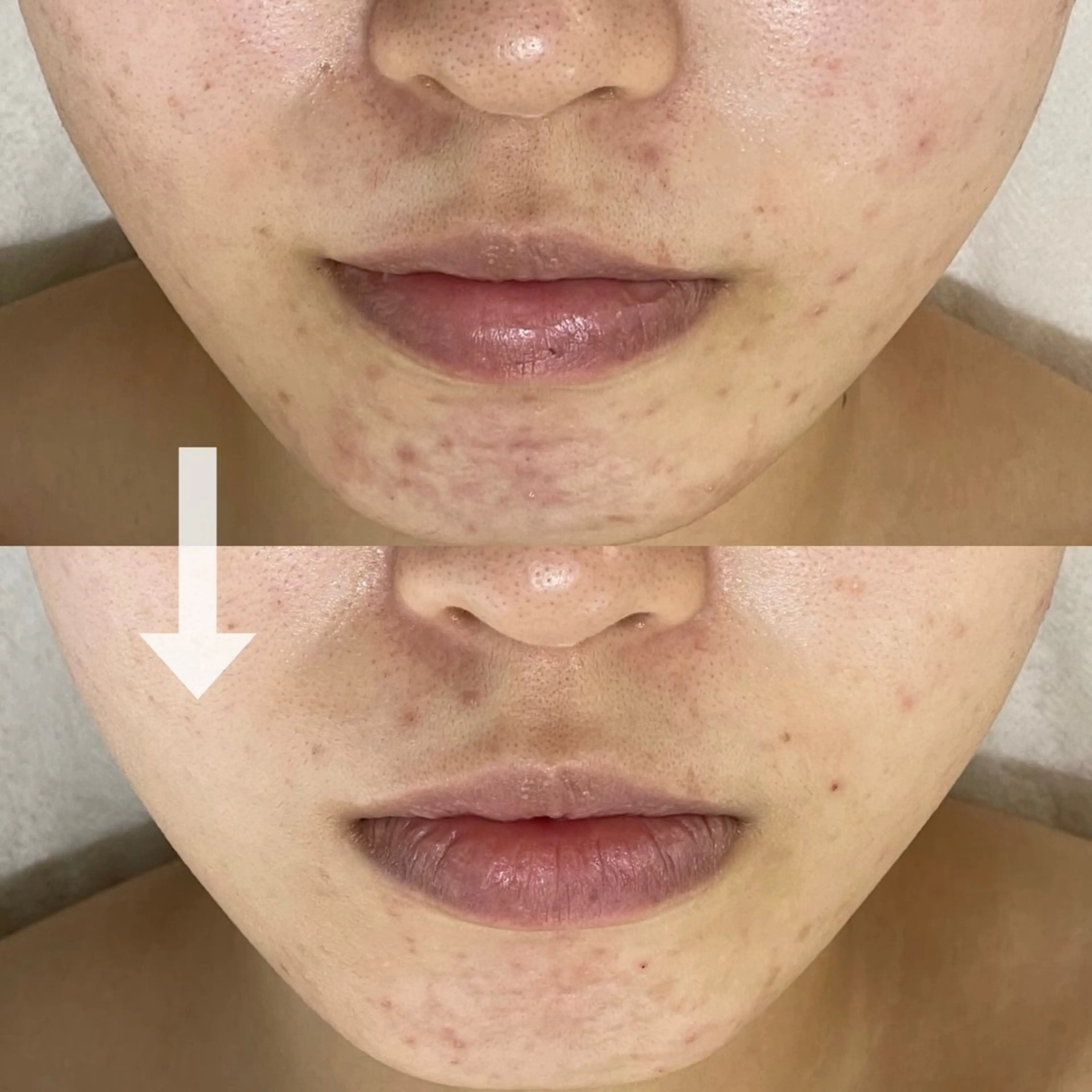 ニキビ・毛穴・ フェイシャル専門店のエステ・リラクイメージ