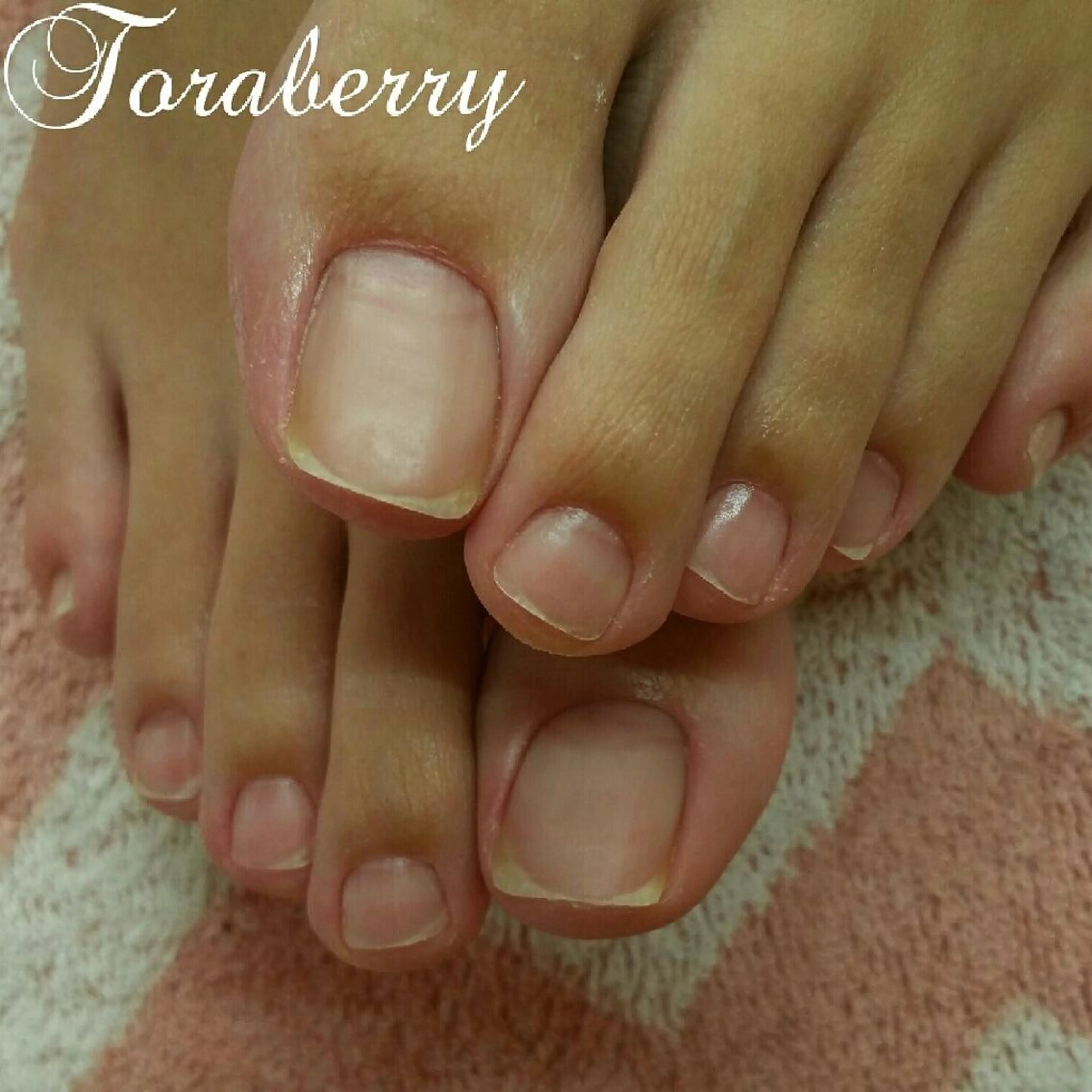 フットジェルオフケアコースの写真