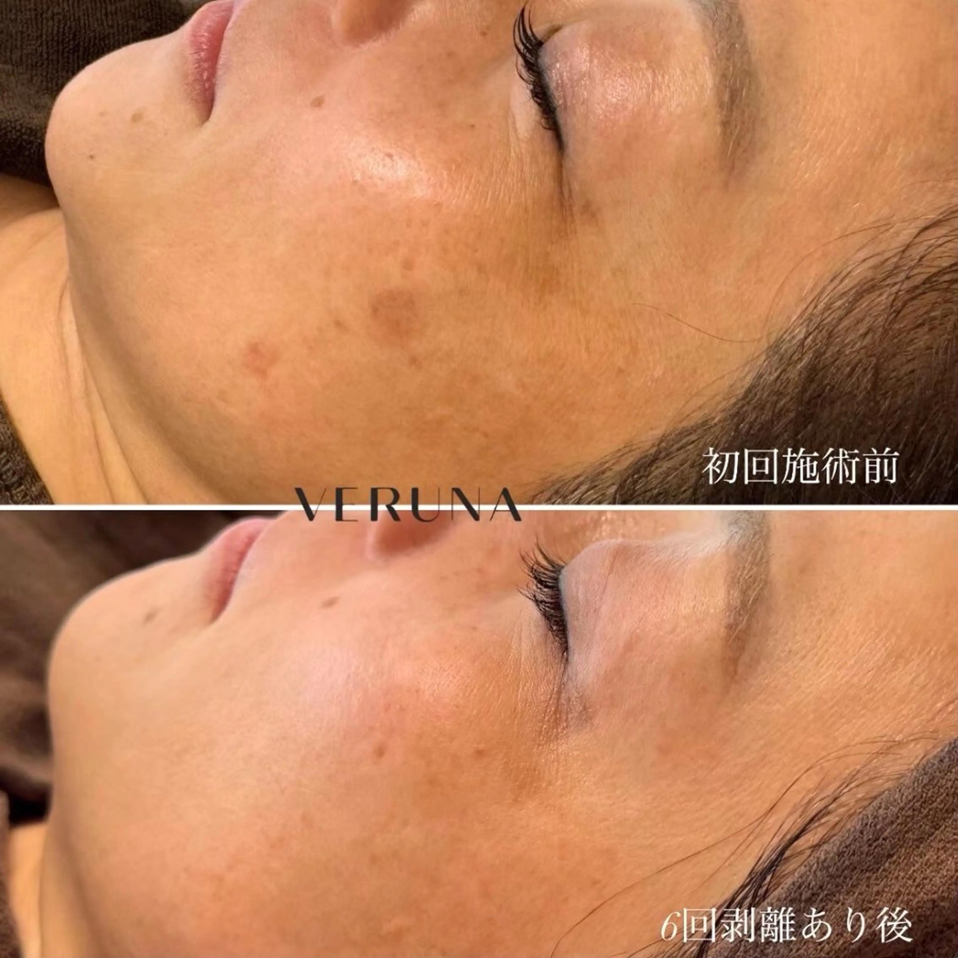 ハーブピーリング専門 葵/LUNEAのエステ・リラクイメージ