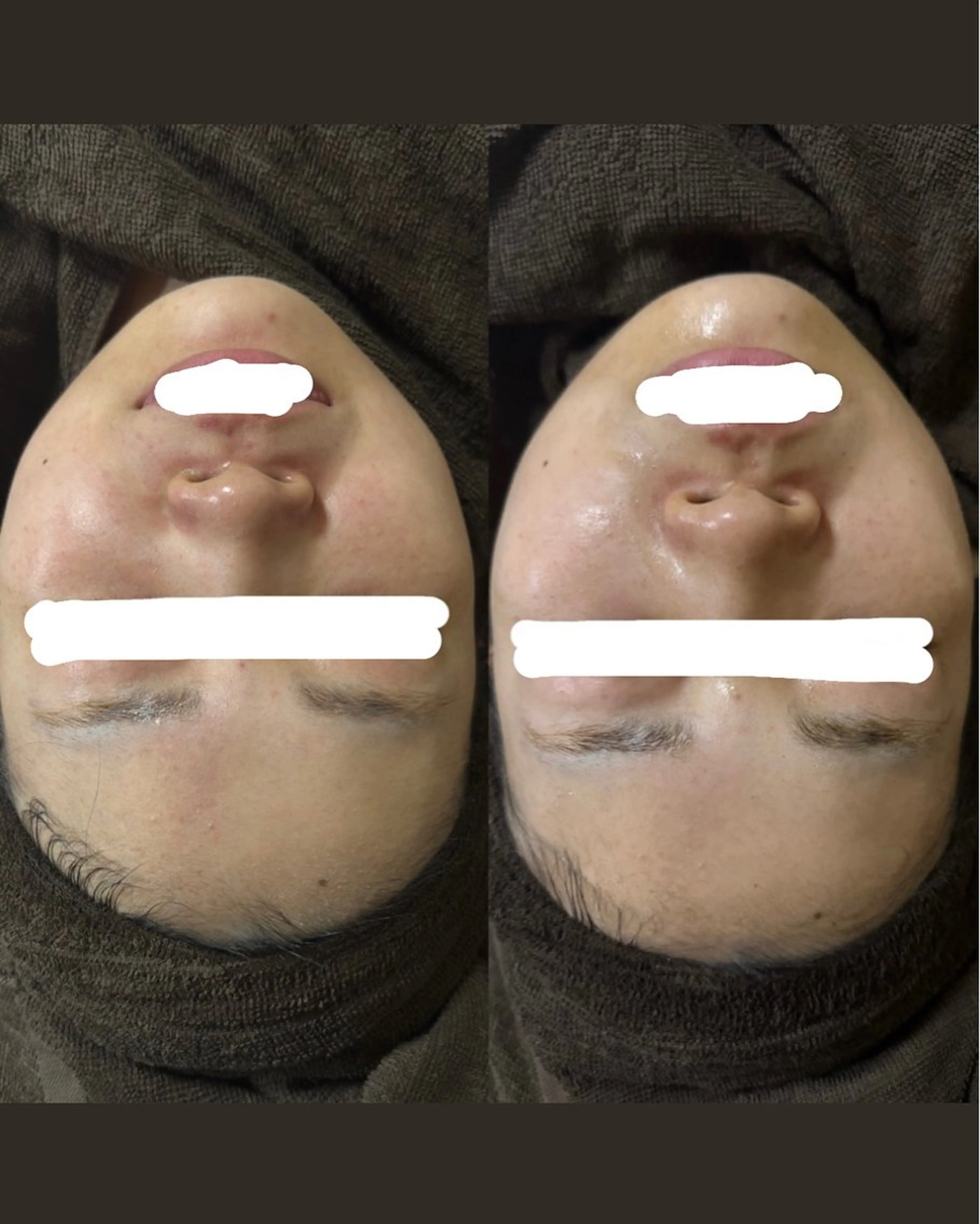 ENoa ハーブピーリング専門のエステ・リラクイメージ