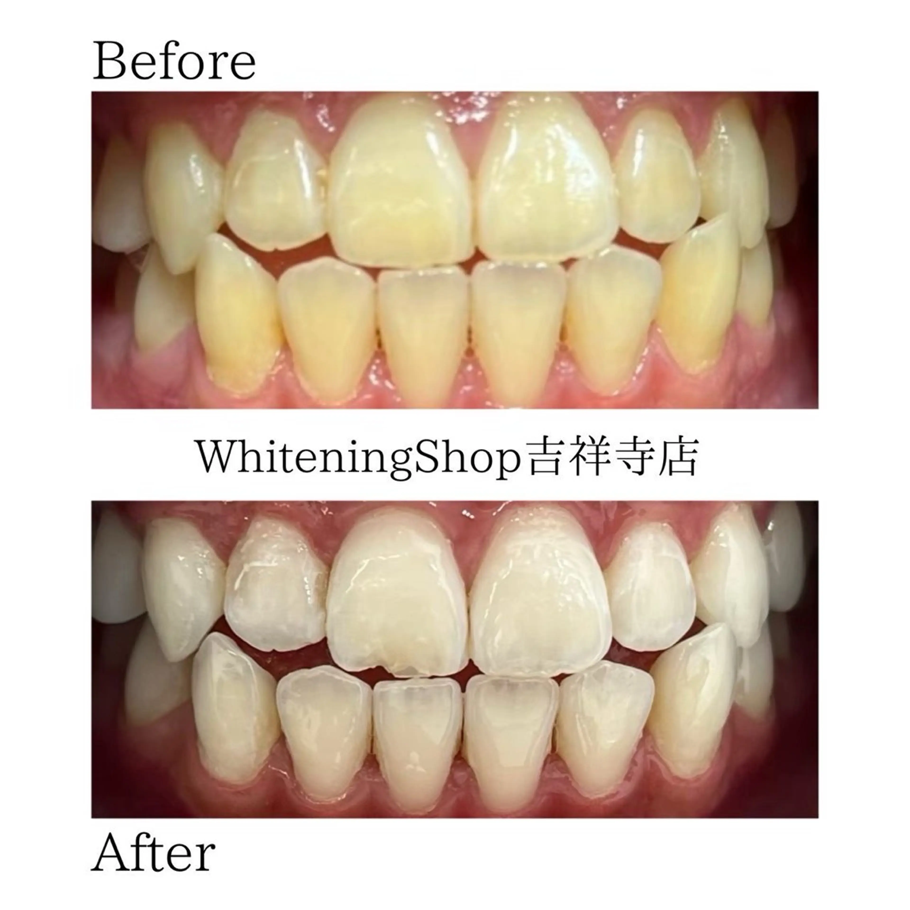 ホワイトニングショッ 吉祥寺2号店のその他イメージ