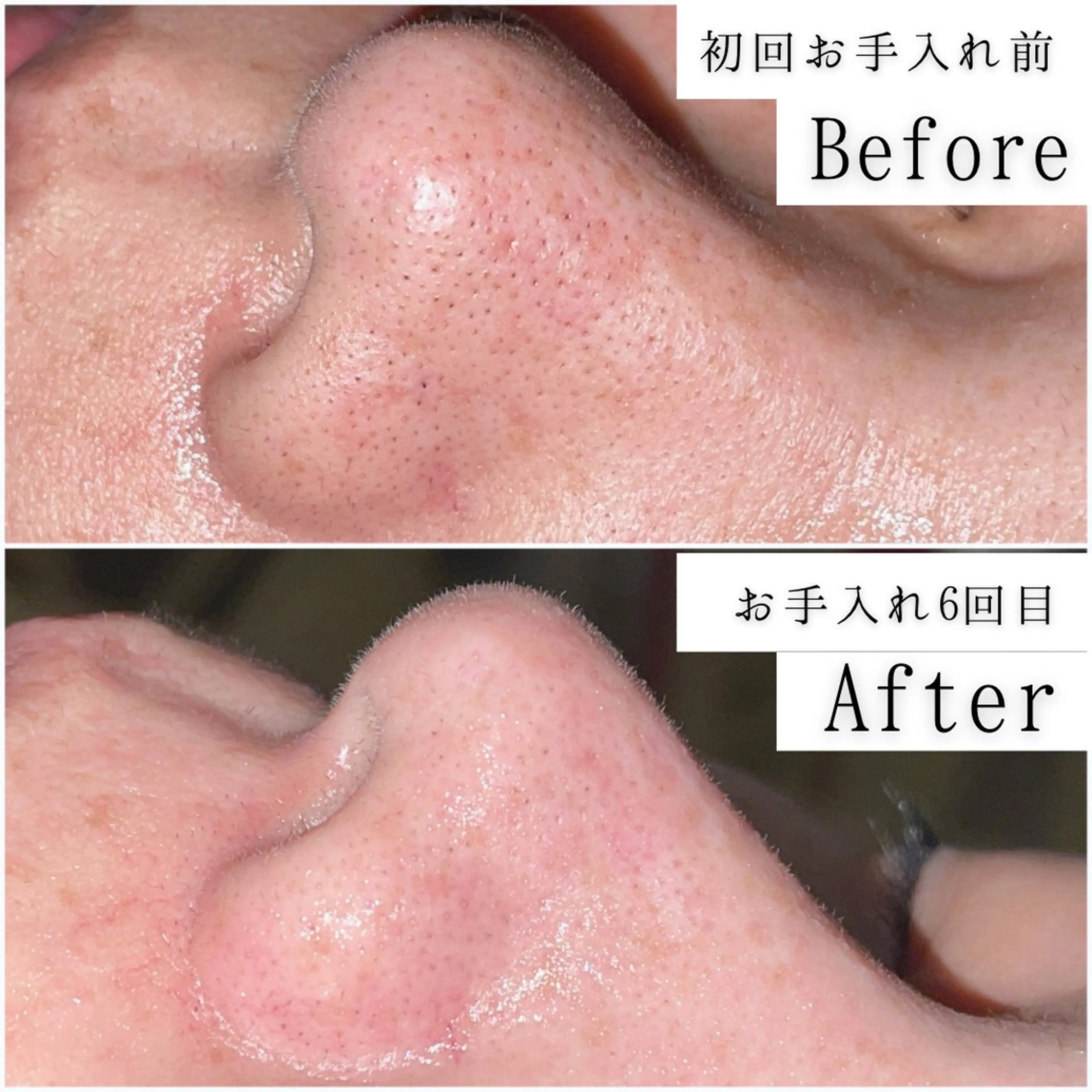 エステ gracia 浦添店のその他イメージ