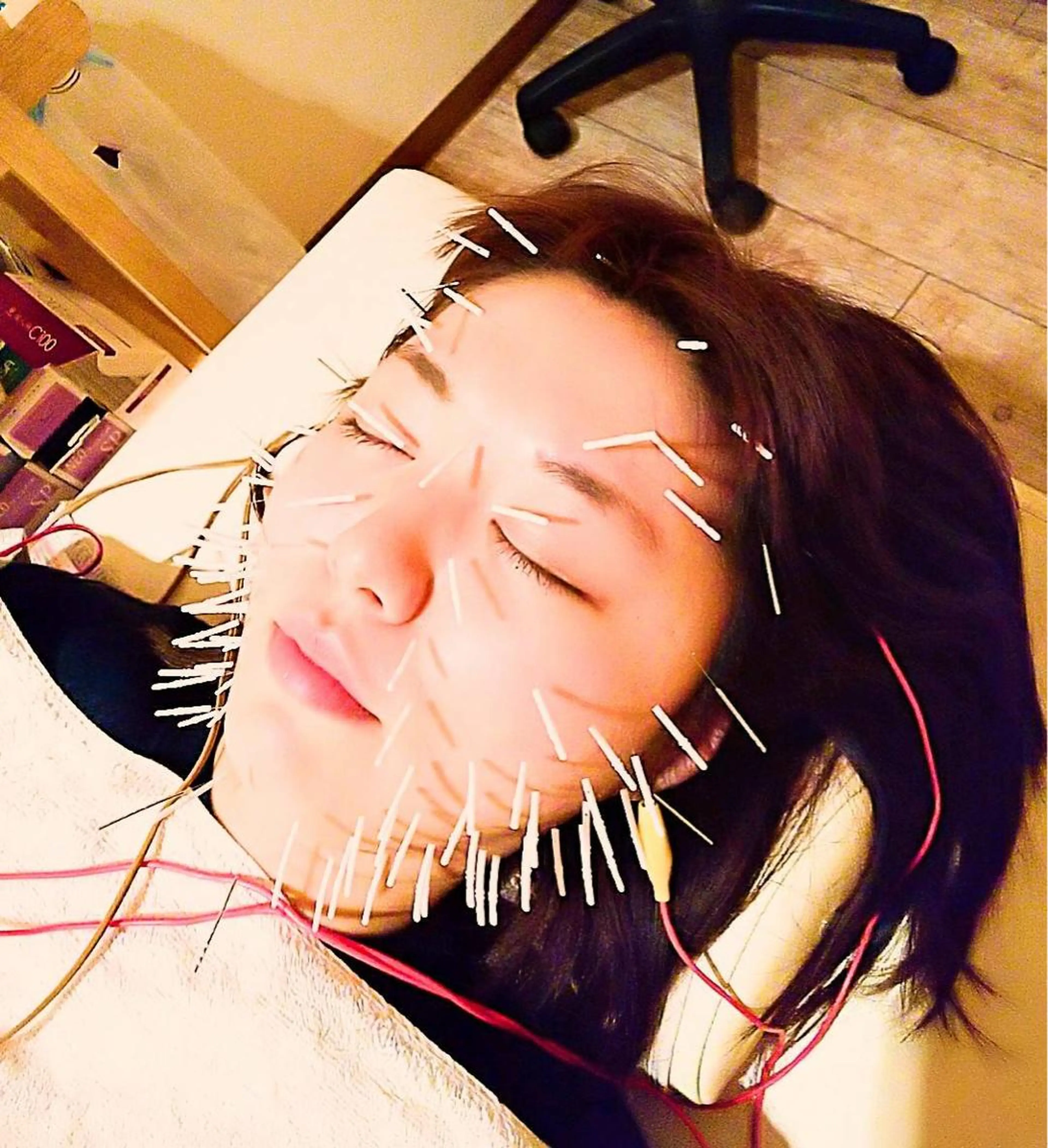 むくみたるみ専門☆ 美容鍼・小顔矯正のエステ・リラクイメージ