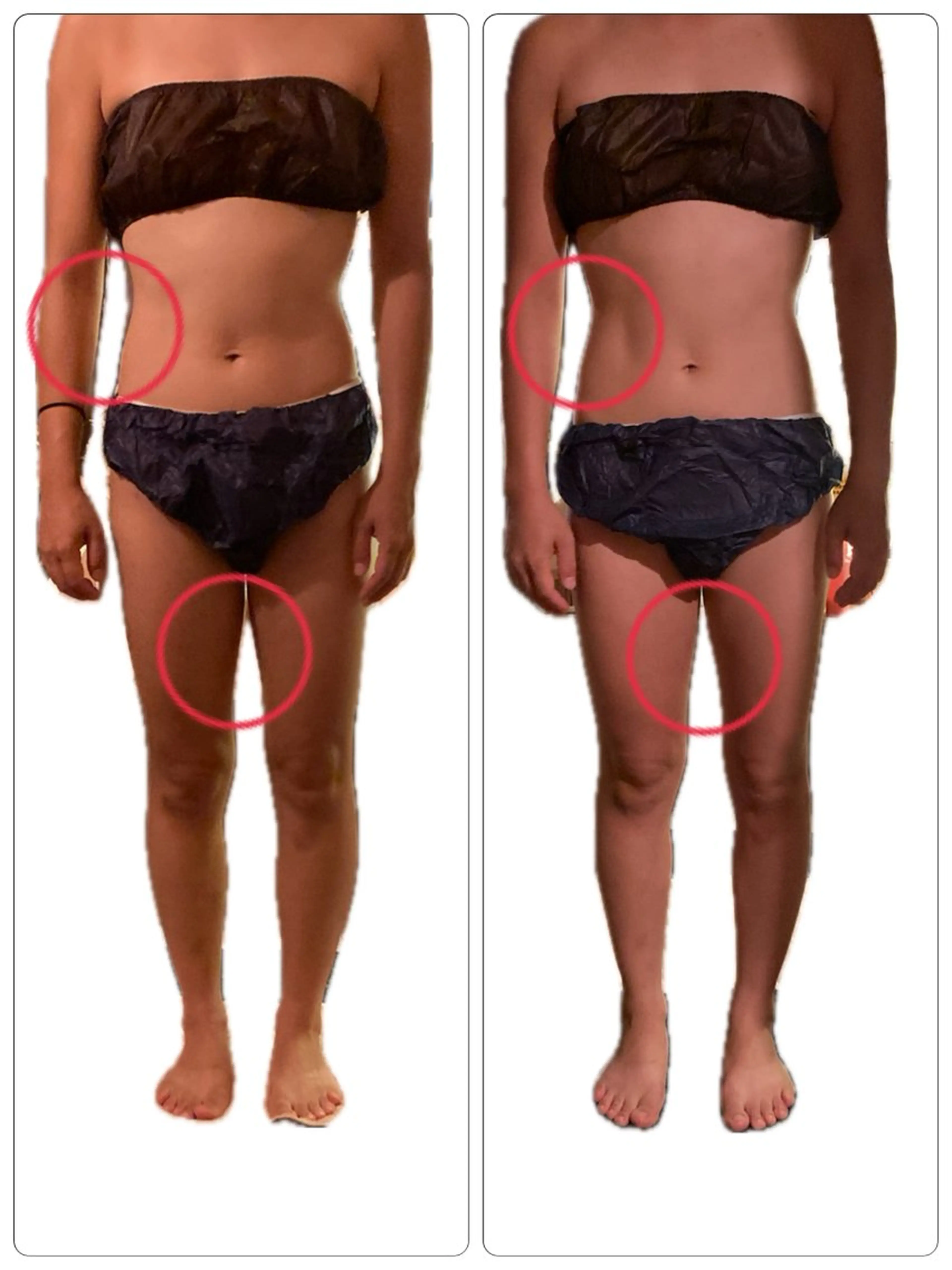 エステ 温活痩身サロン LILYのエステ・リラクイメージ