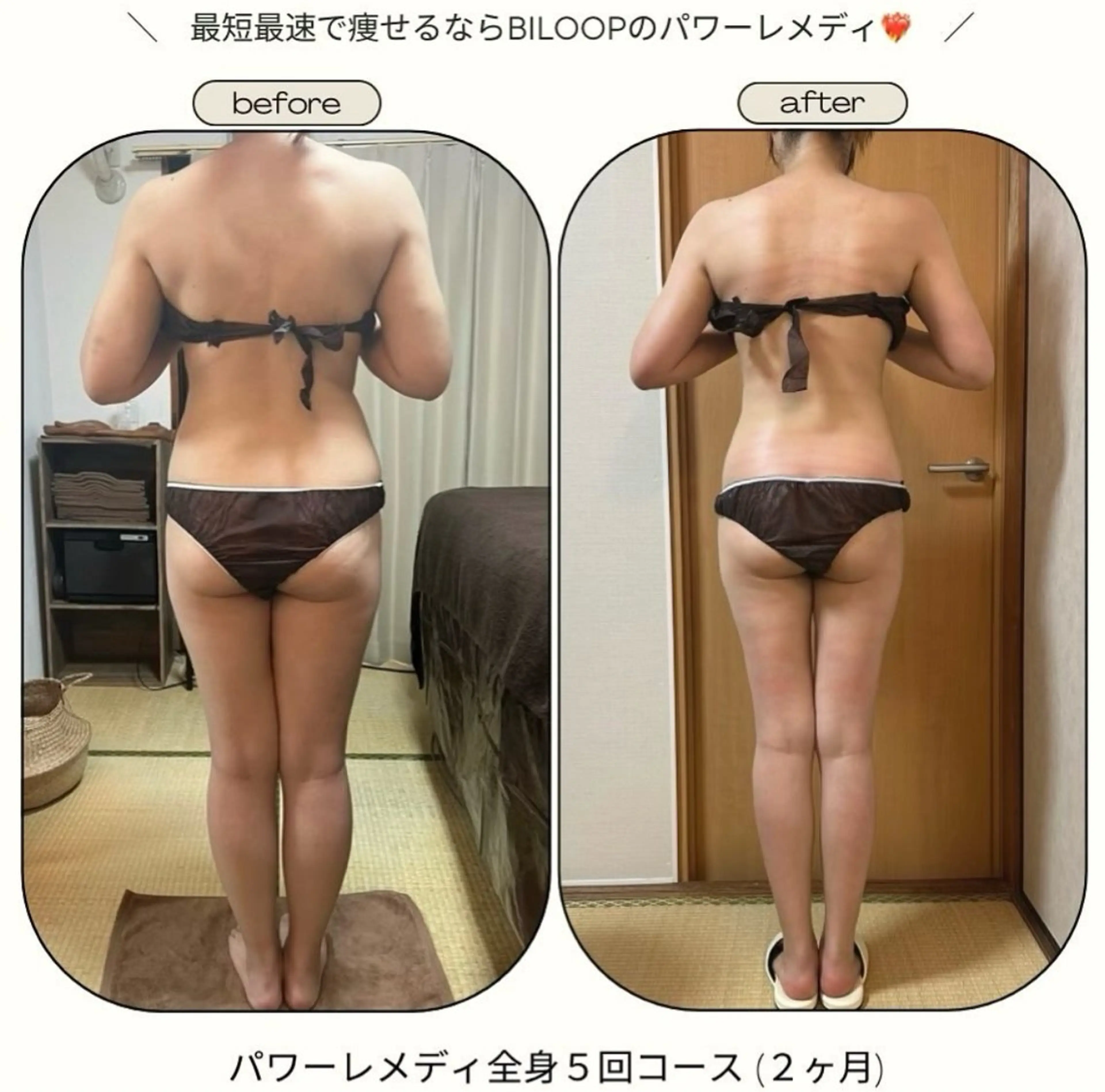 《本気痩せ×疲労改善 》  BILOOPのエステ・リラクイメージ