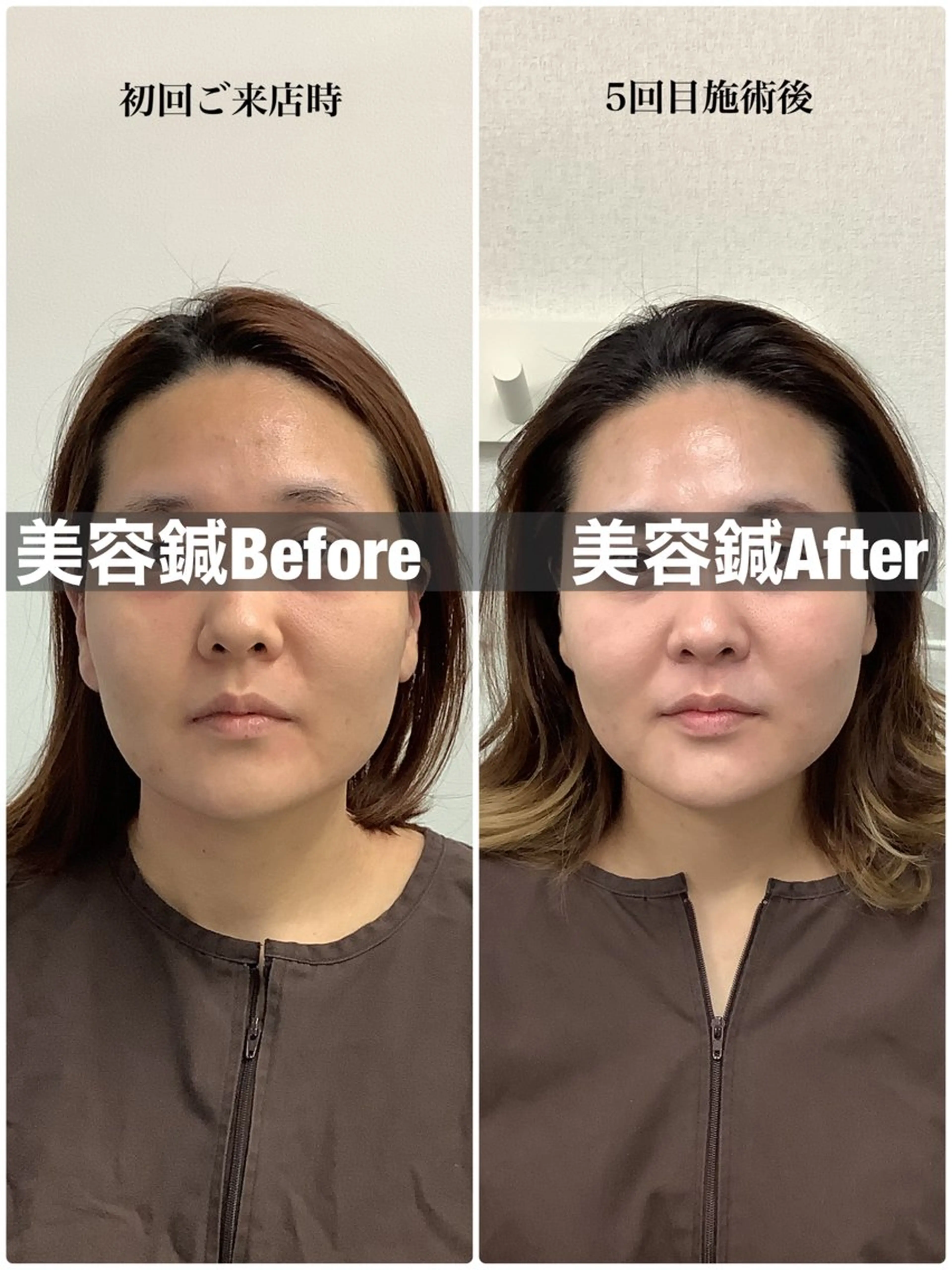 エステ リラク メディカルサロンドオフ所属・ハリサロンドオフ 美容鍼灸×小顔整体のエステ・リラクイメージ