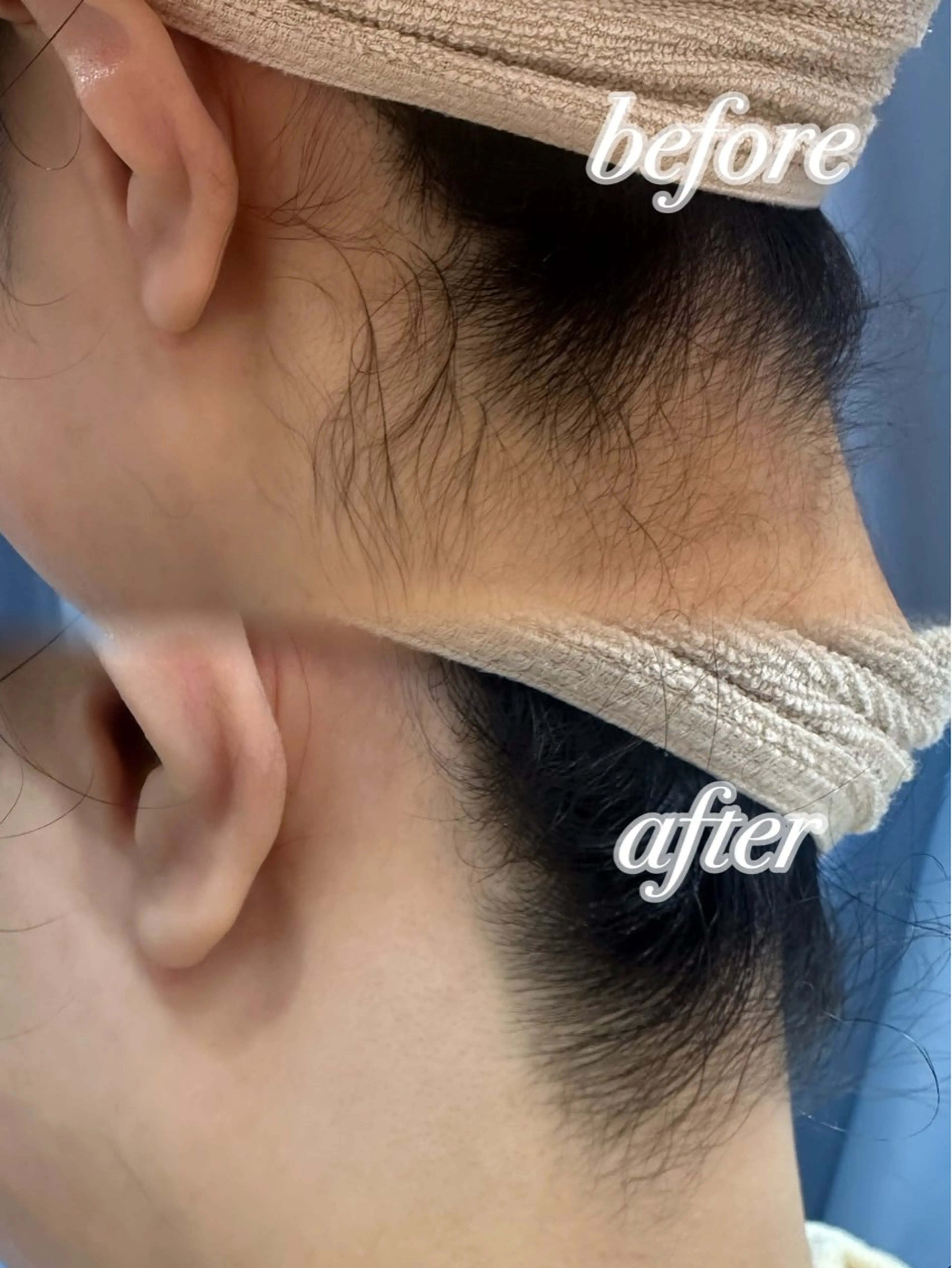 ぷる艶肌🫧 shaving斉藤のその他イメージ