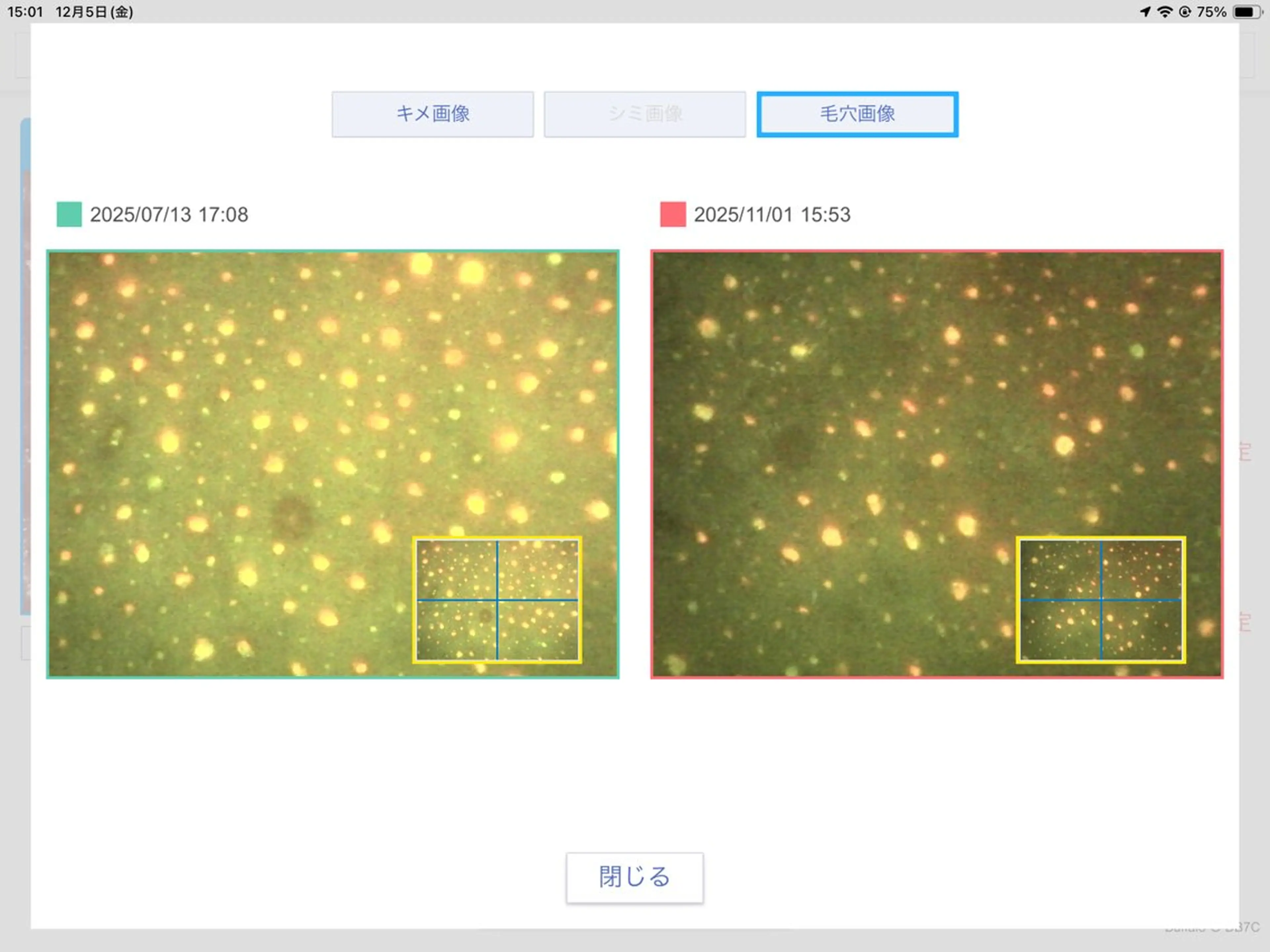 エステ ジャン ユイツのエステ・リラクイメージ
