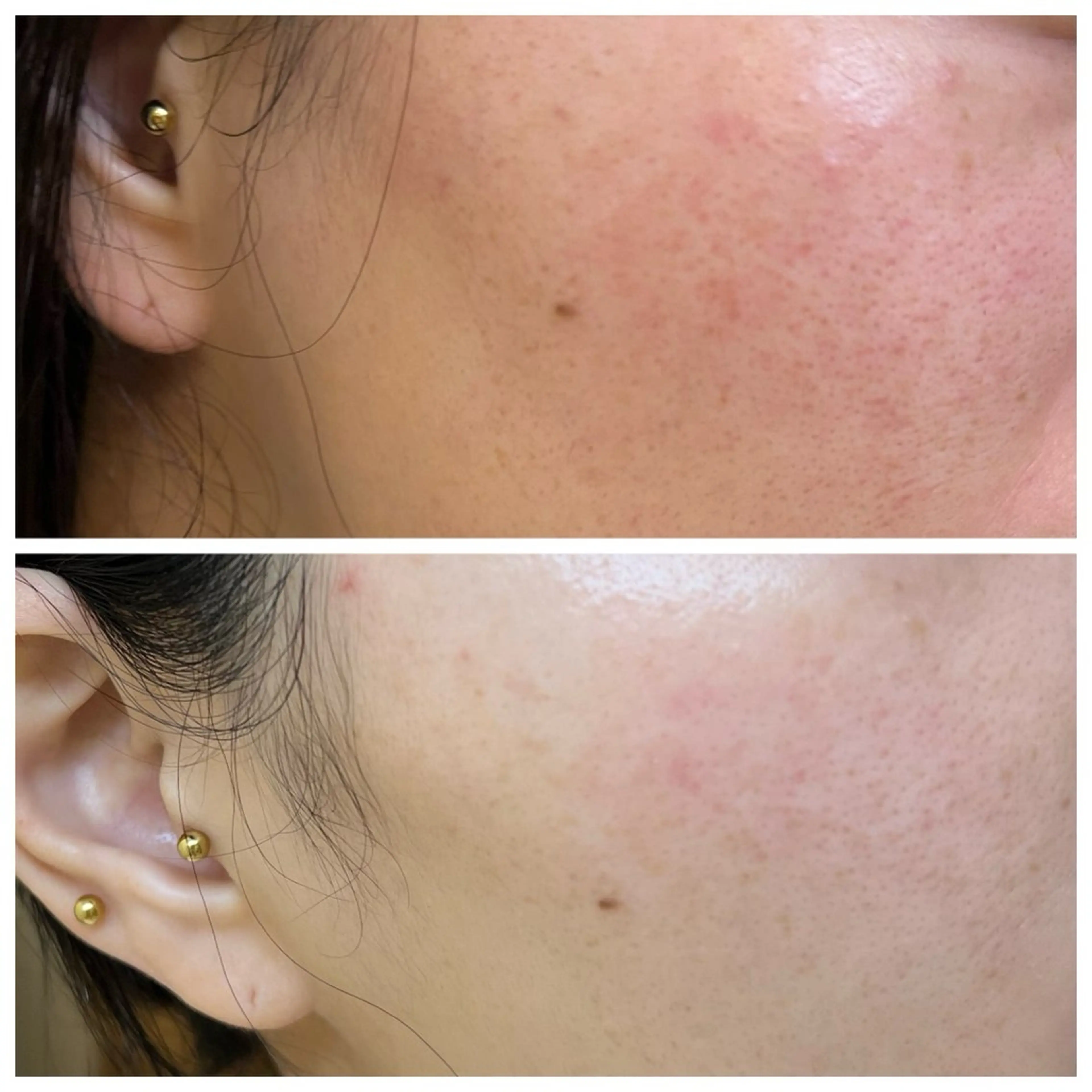 A.所属・Raviy(A.) 【痩身・韓国肌管理】のエステ・リラクイメージ