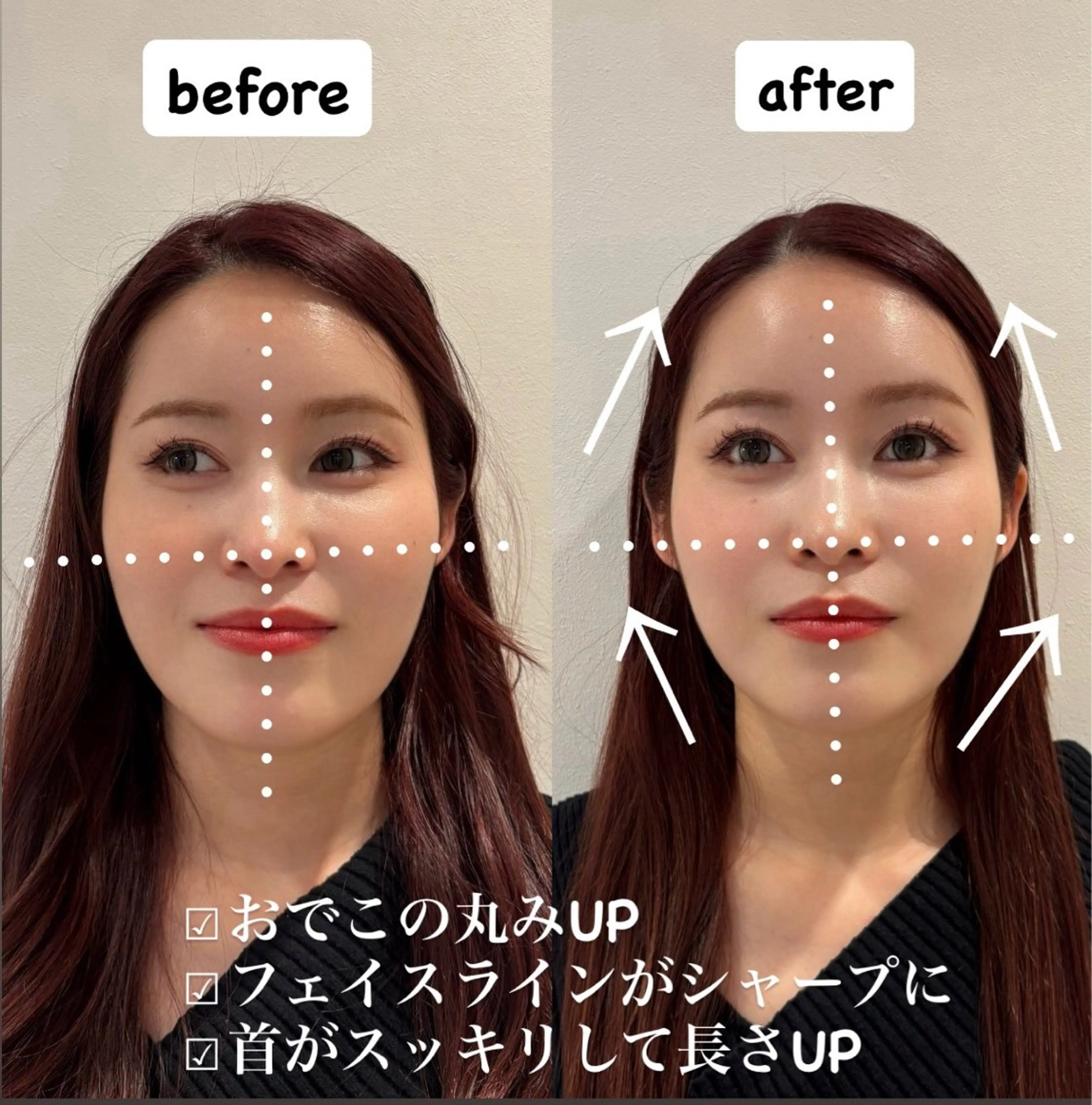 骨格矯正ヘッドスパ90分(歪み解消)の写真