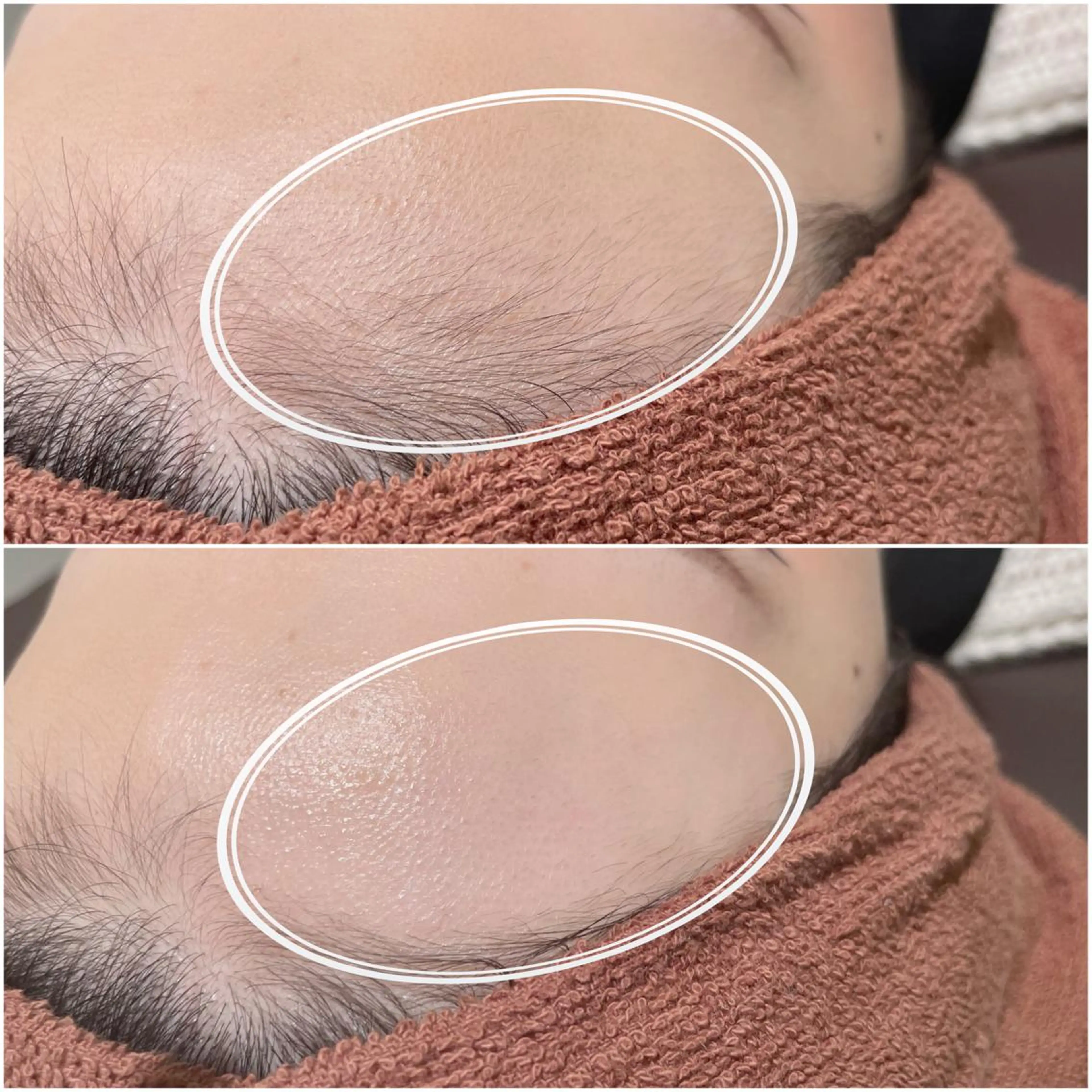 REVE （レーヴ）のマツエク・マツパデザイン