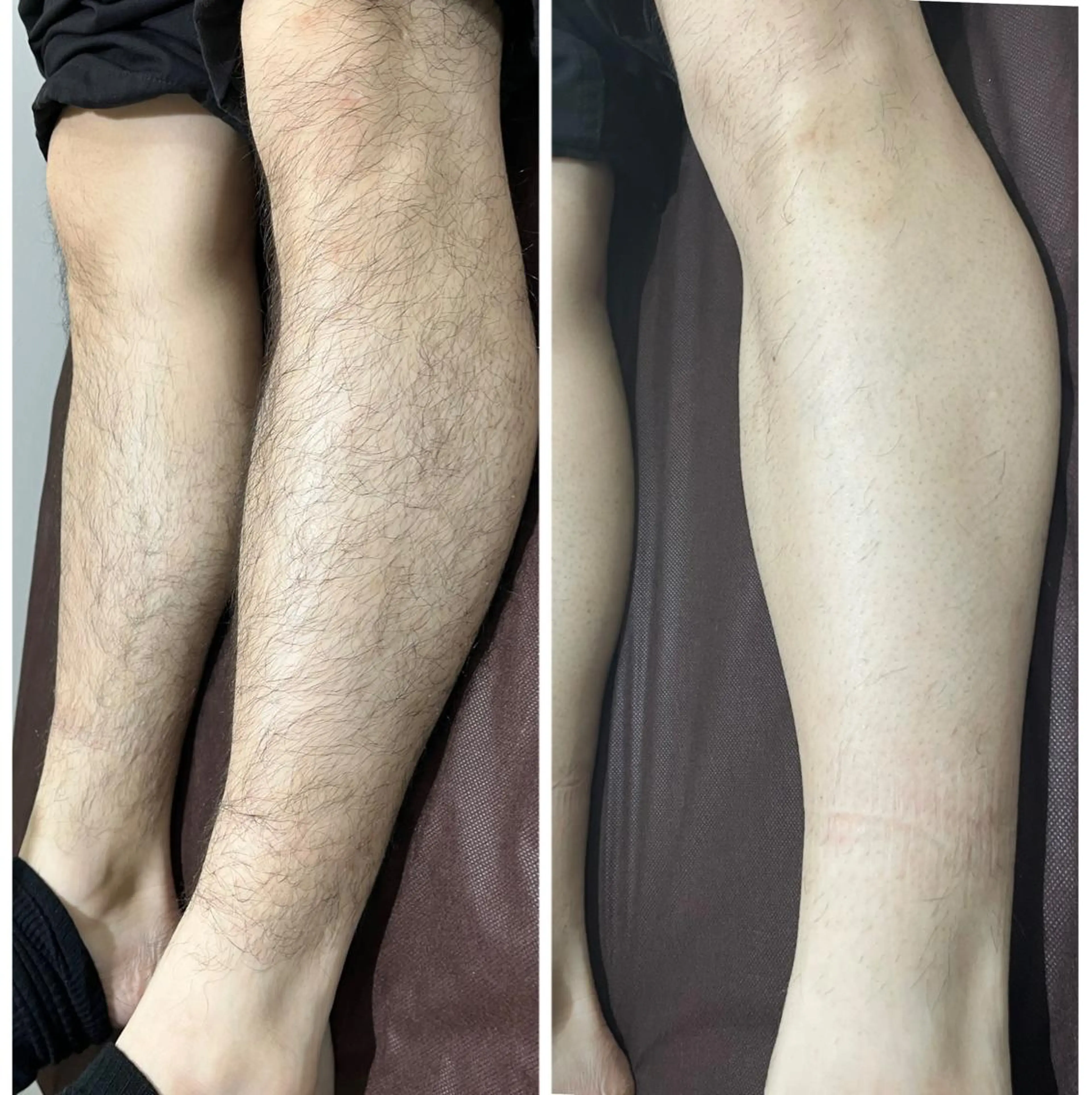 脱毛 【Diar】オーナー アキヨシケンタのヘアスタイル