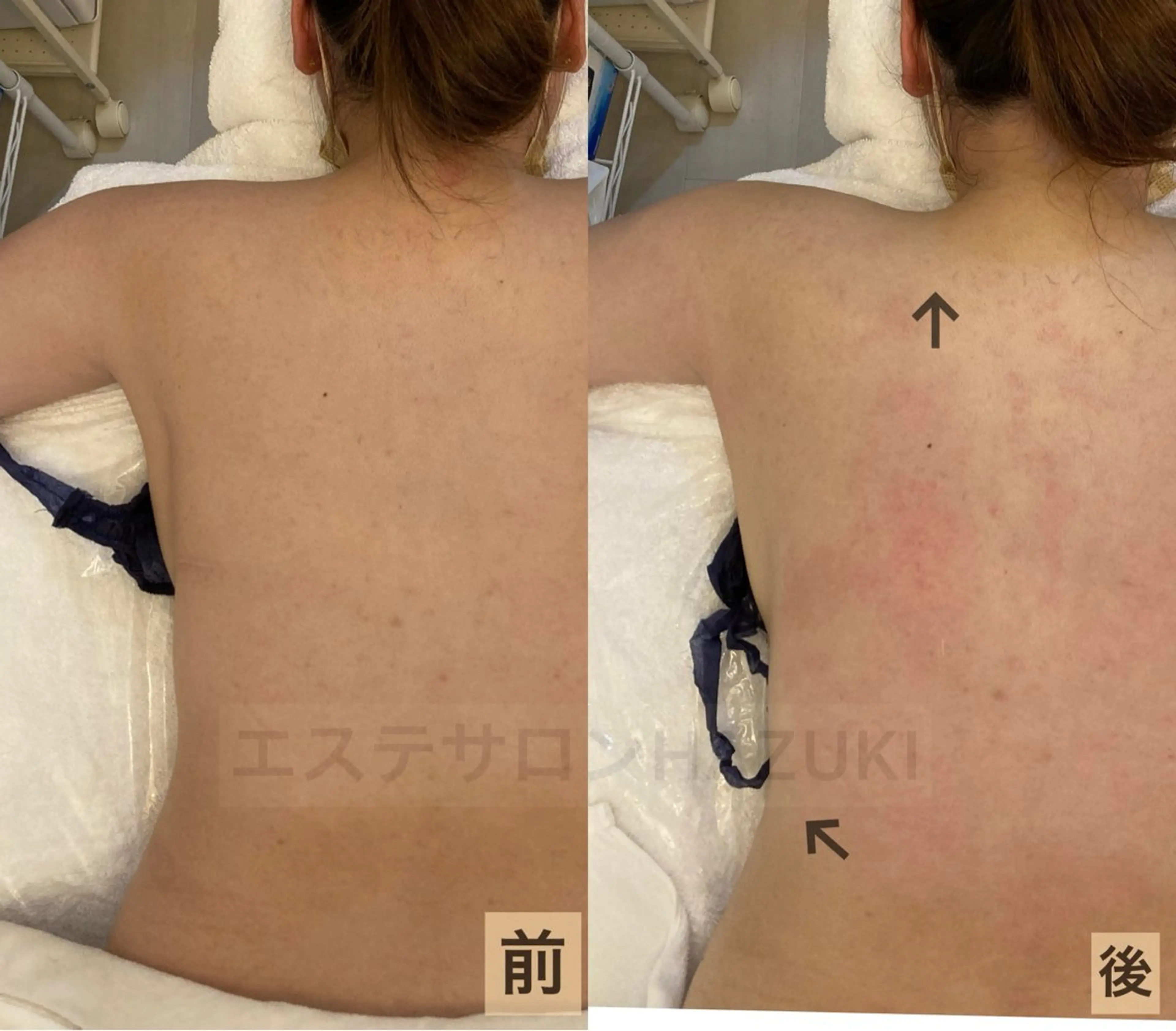 たるみ改善小顔エステ 堀葉月のその他イメージ