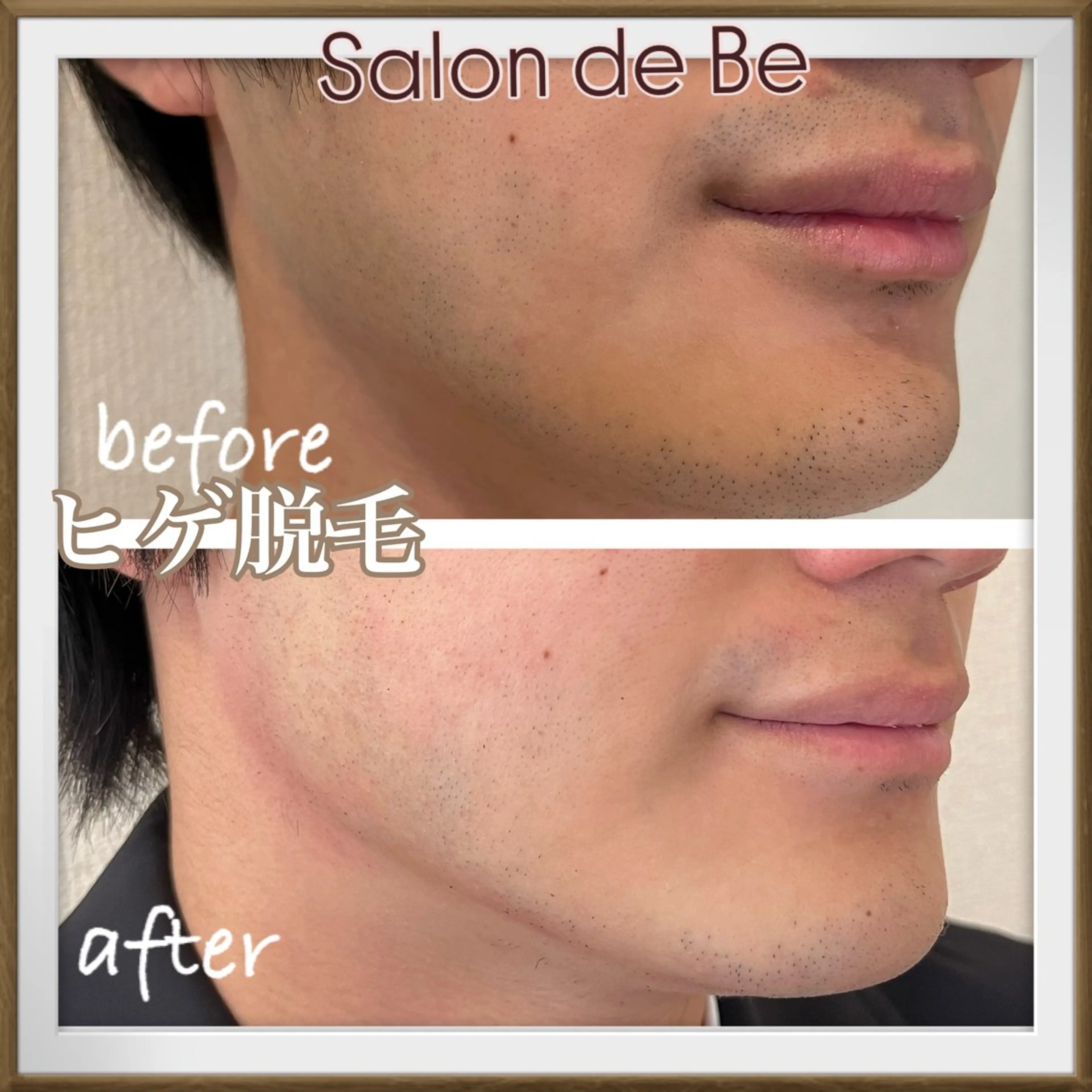 メンズ Salon de Beのエステ・リラクイメージ