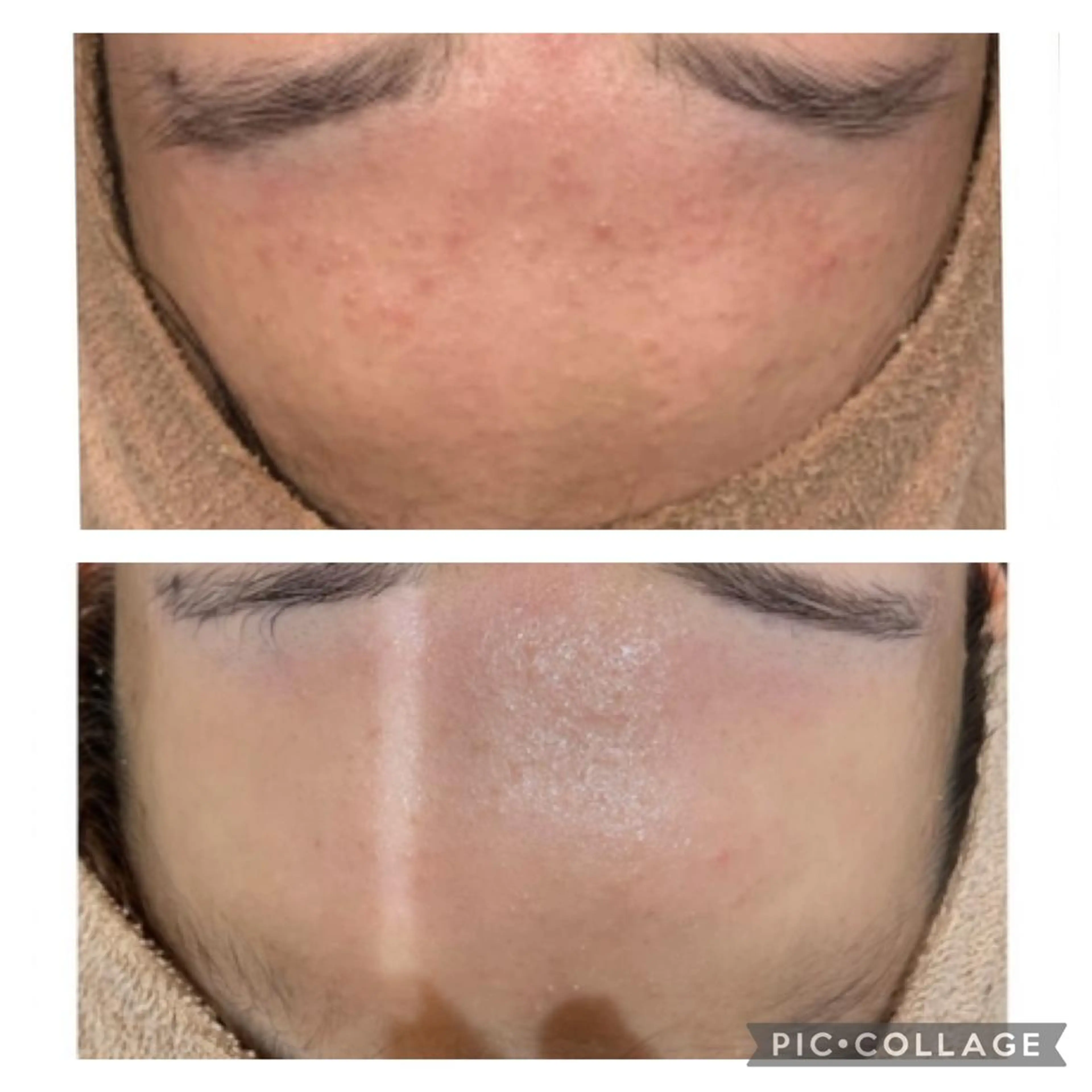 🤍Linola🤍 レイビス 須藤のエステ・リラクイメージ