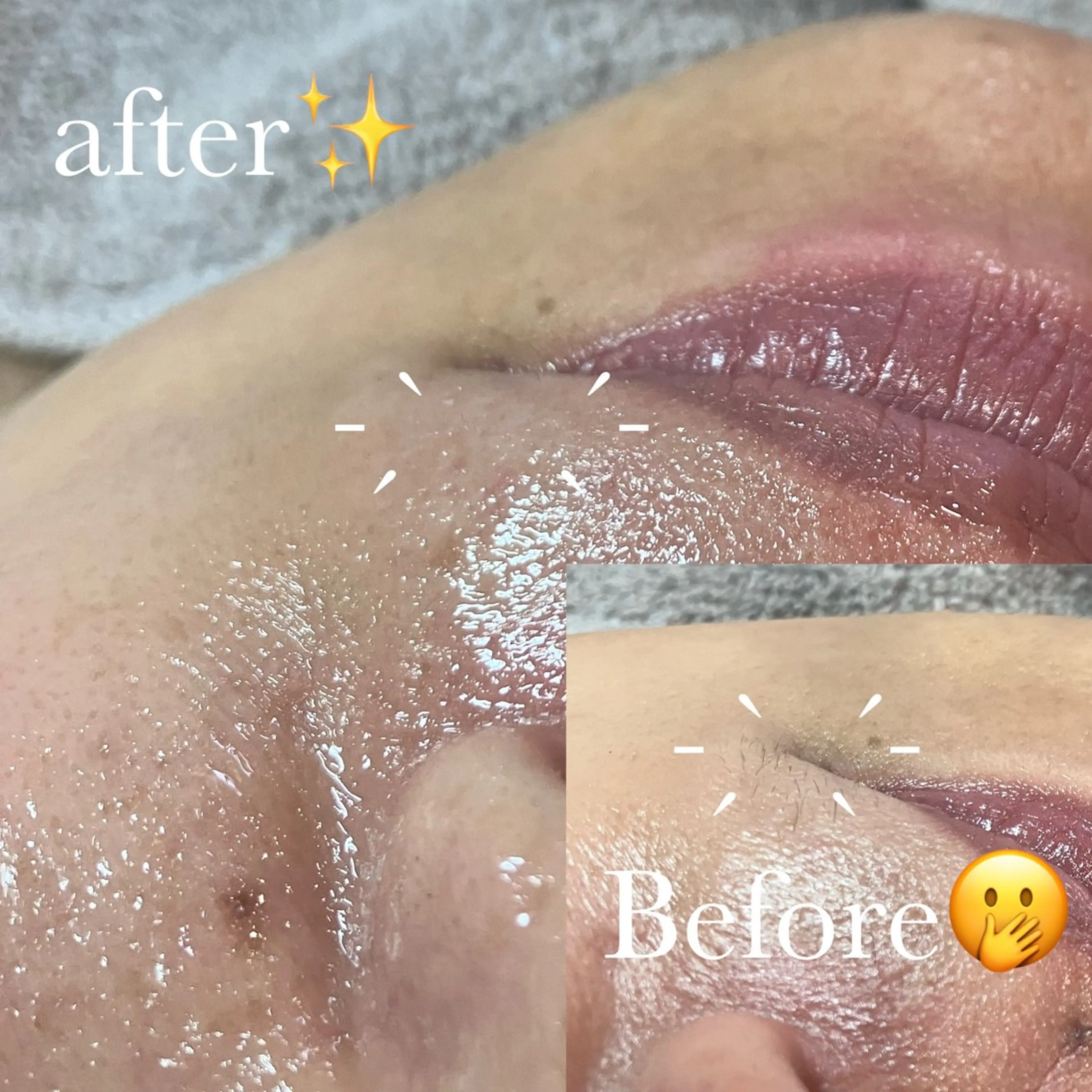 パーツwax🍯🪄『口周り』•『鼻』•『あご』いずれか1箇所の写真