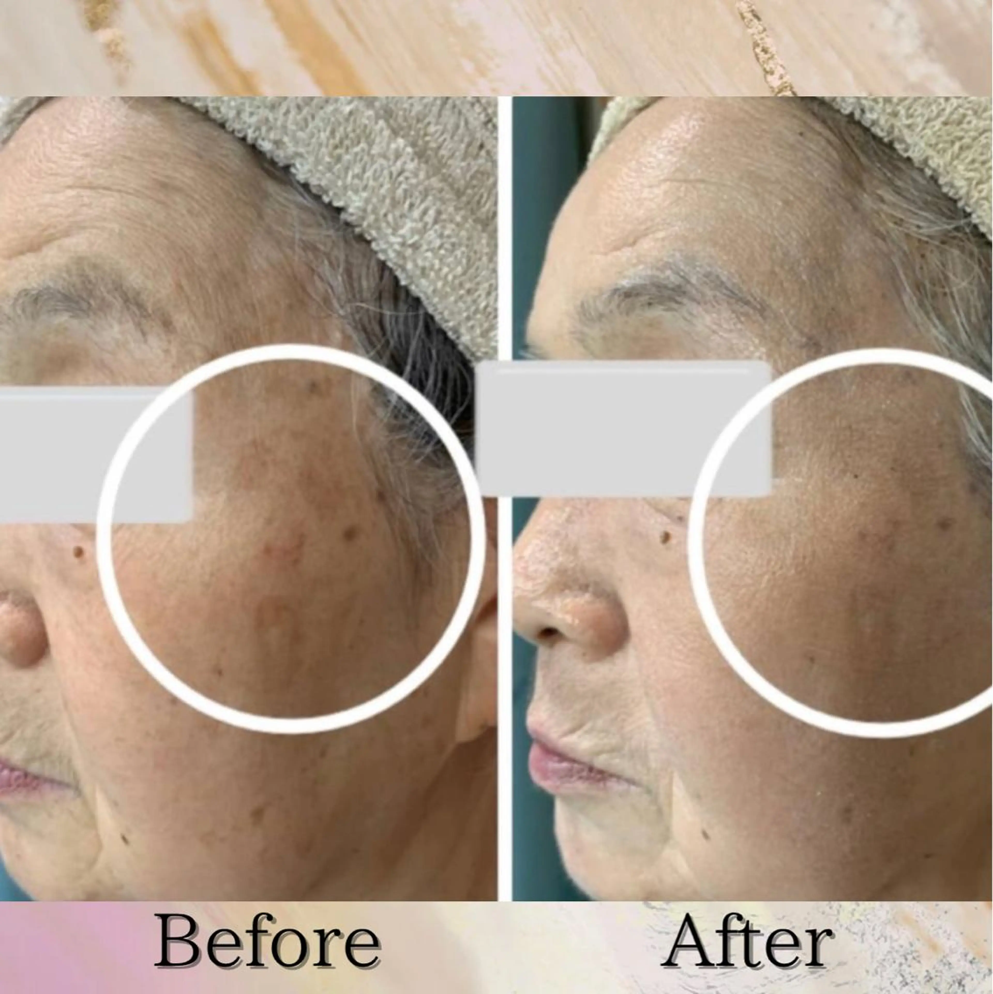 Lumiere despoir所属・Lumiere despoirのエステ・リラクイメージ