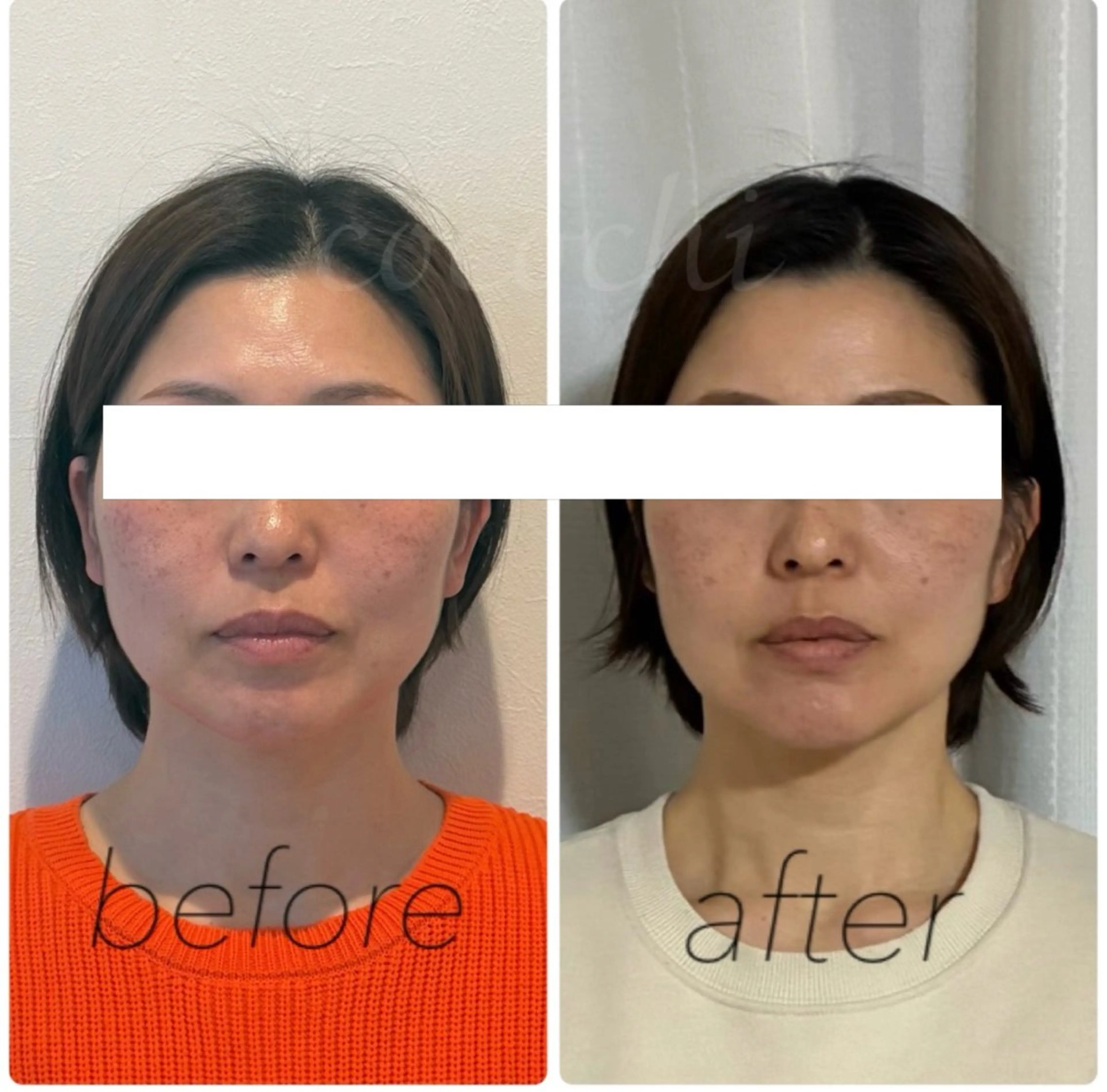 エステ リラク 小顔と ヘッドスパのお店のエステ・リラクイメージ