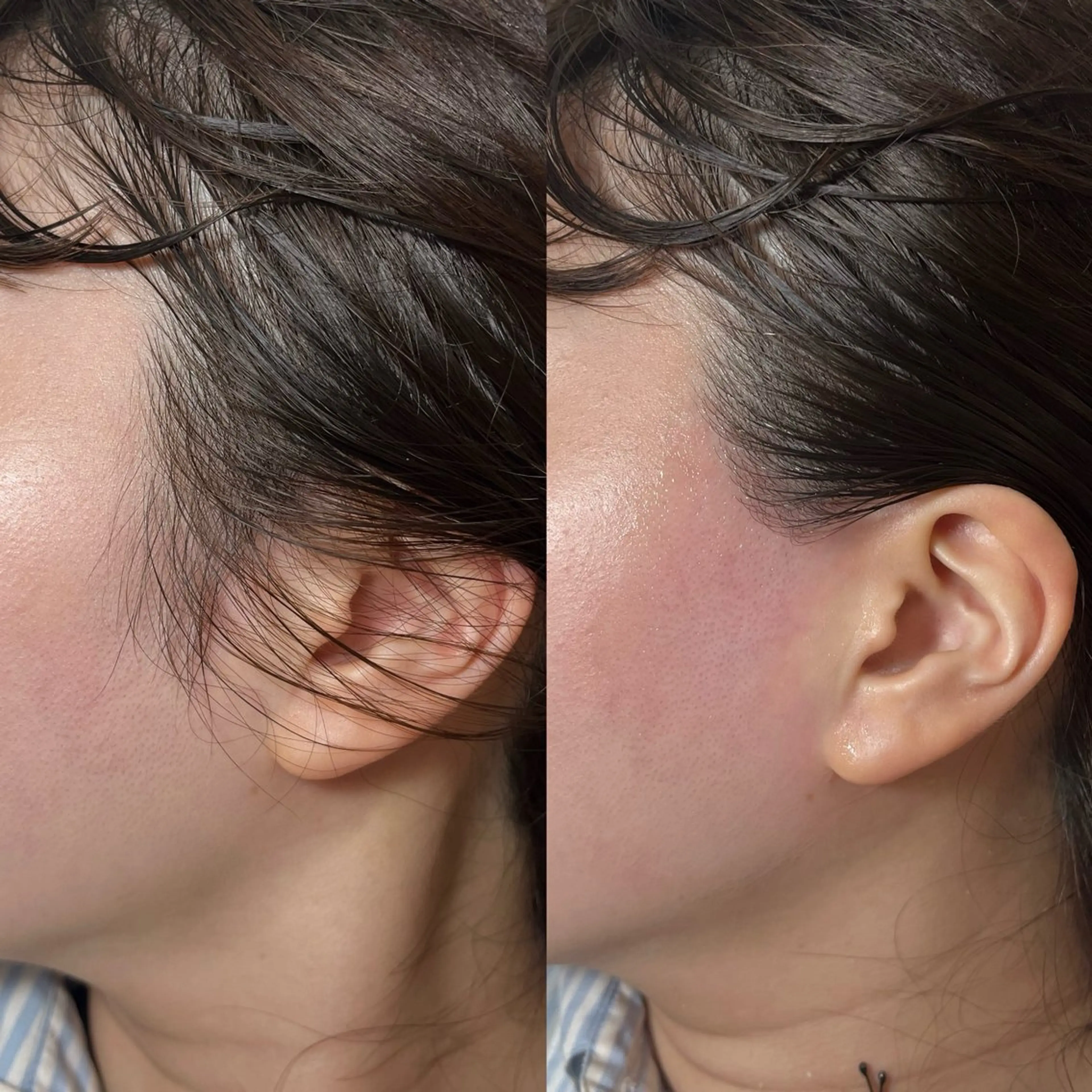 HOTEL&PARK Mikuワックス脱毛のエステ・リラクイメージ