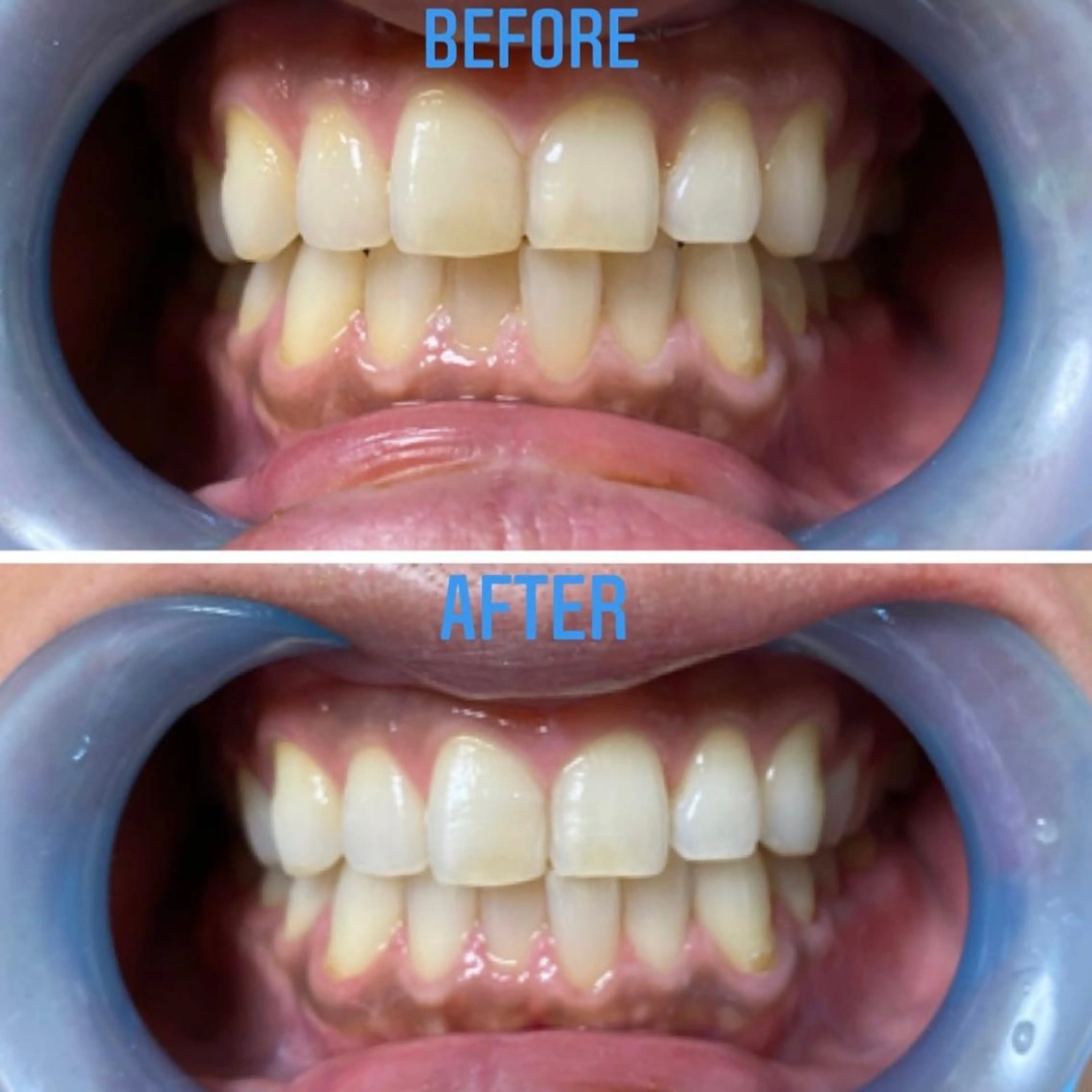 その他 プラティーヌ ボーテのその他イメージ