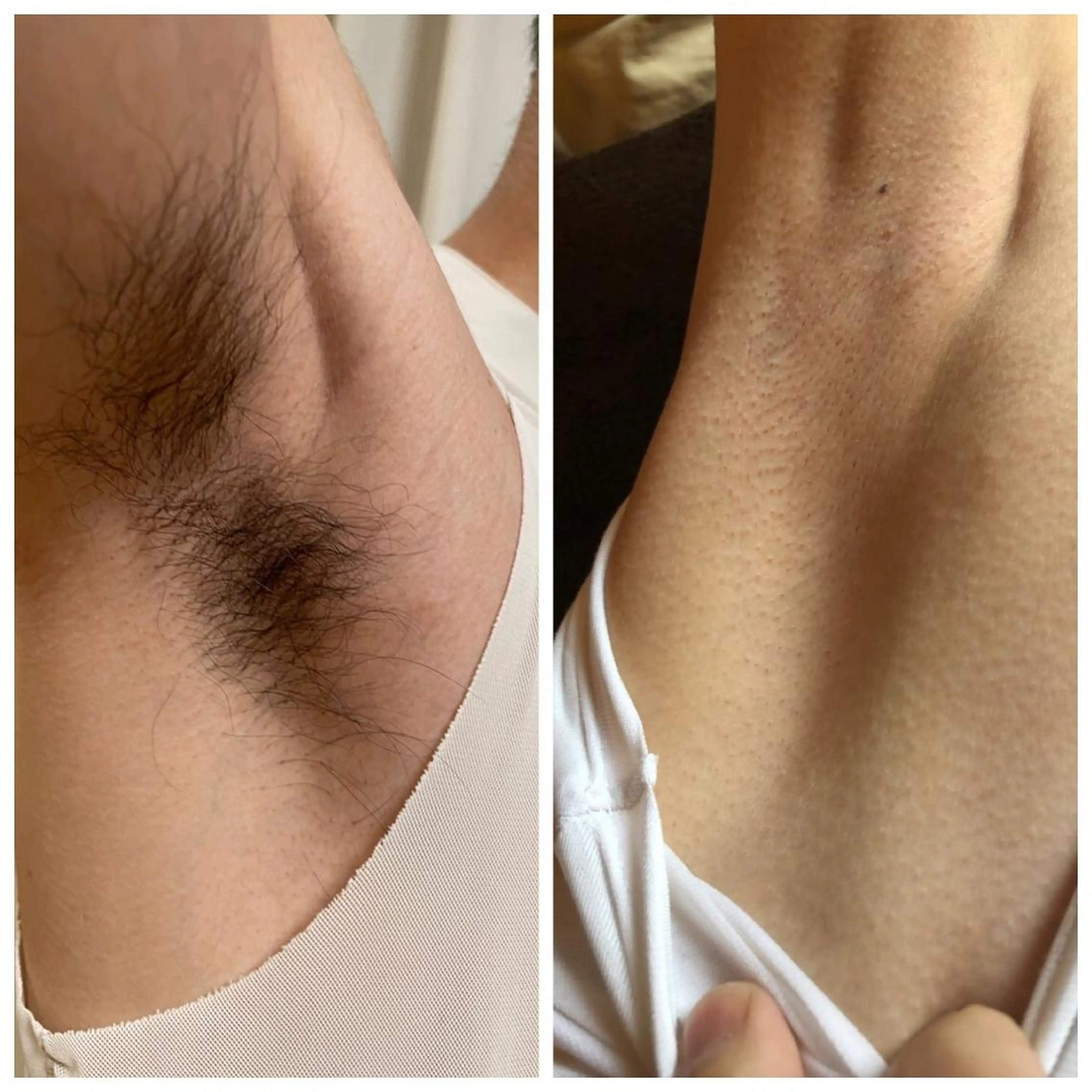 脱毛 muscle＆esthe jonny's beauty所属・jonny's beautyのエステ・リラクイメージ