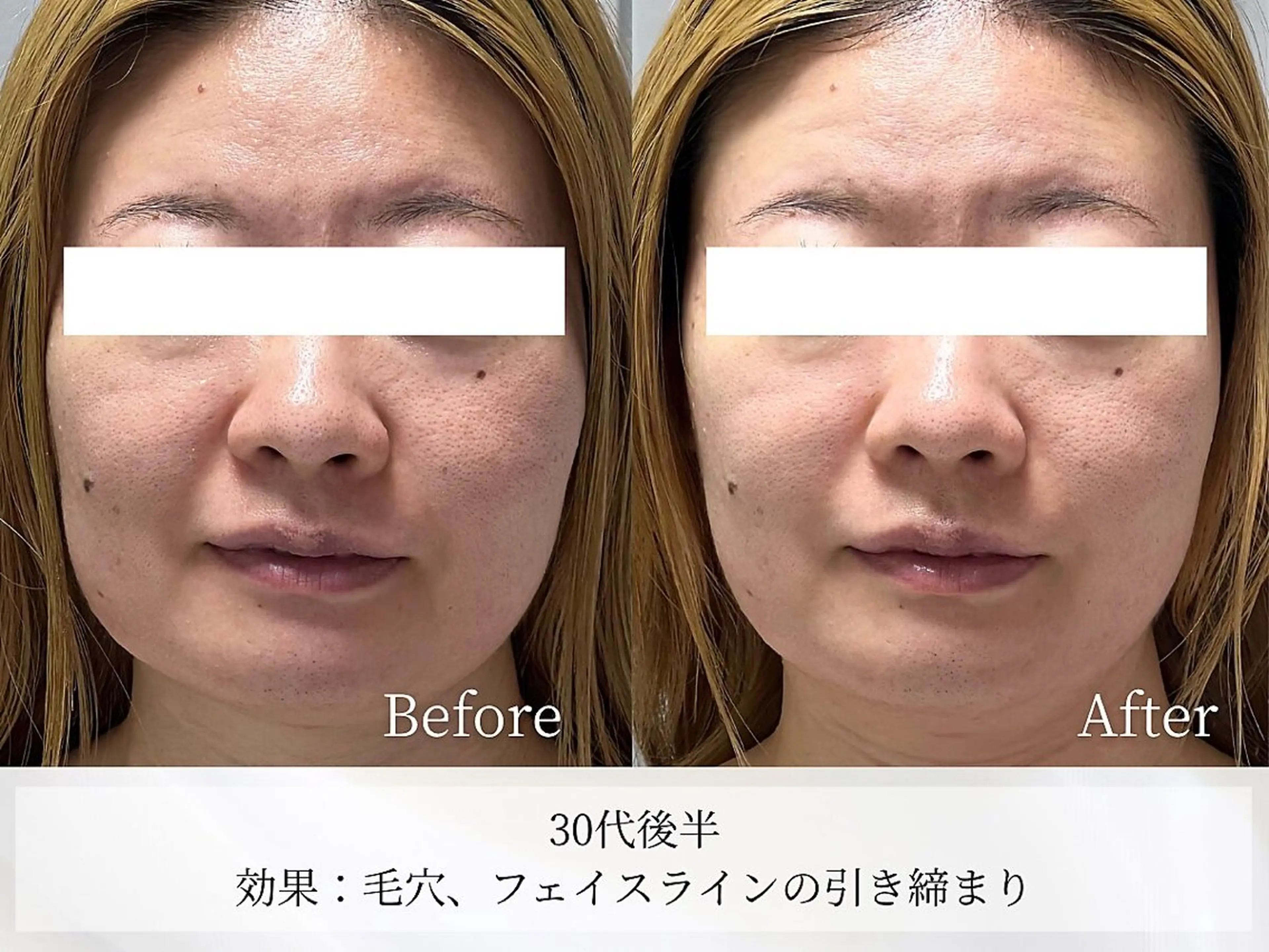 その他 Astorie 相模大野エステのその他イメージ