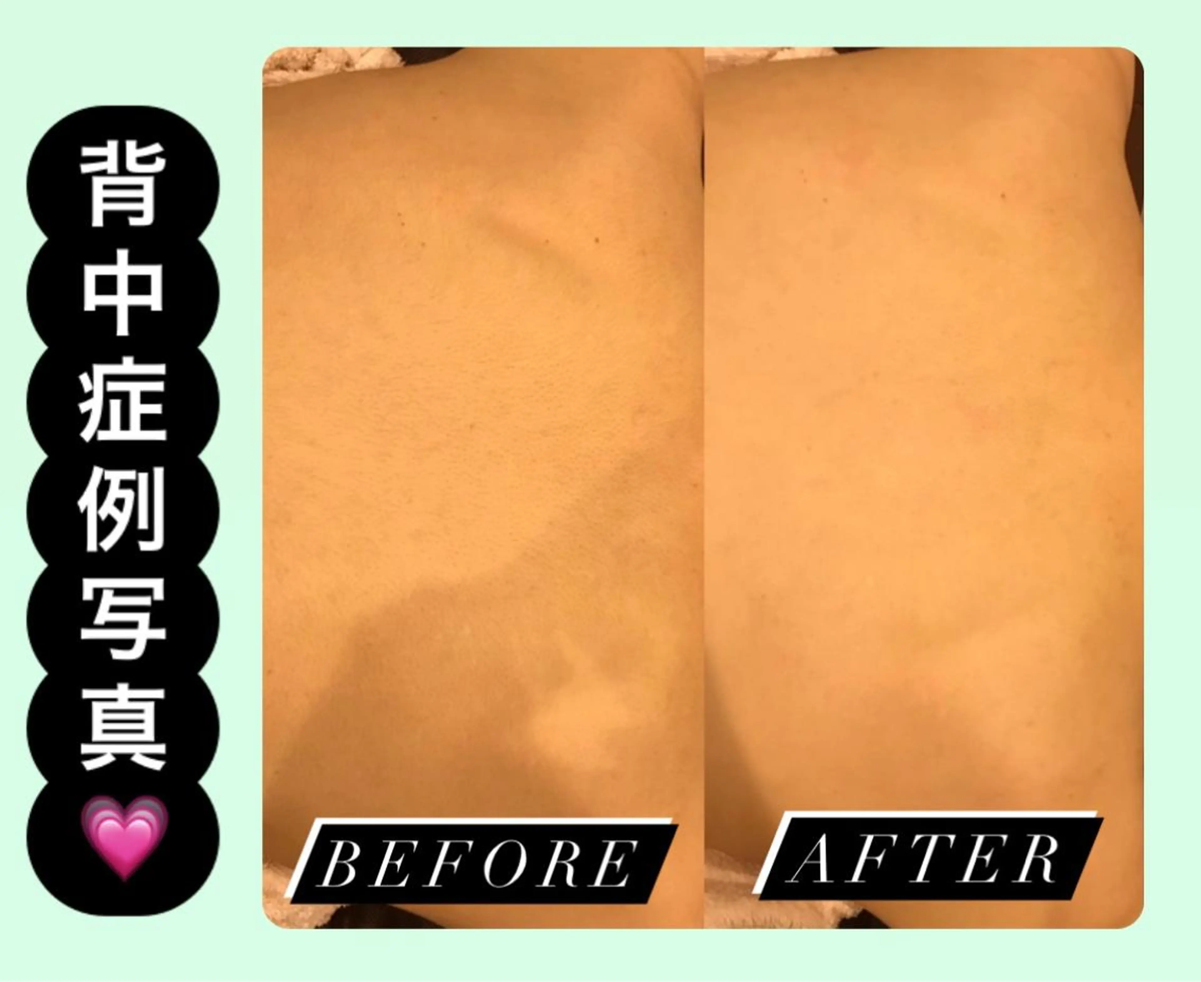 脱毛 ULULU 上野店のエステ・リラクイメージ