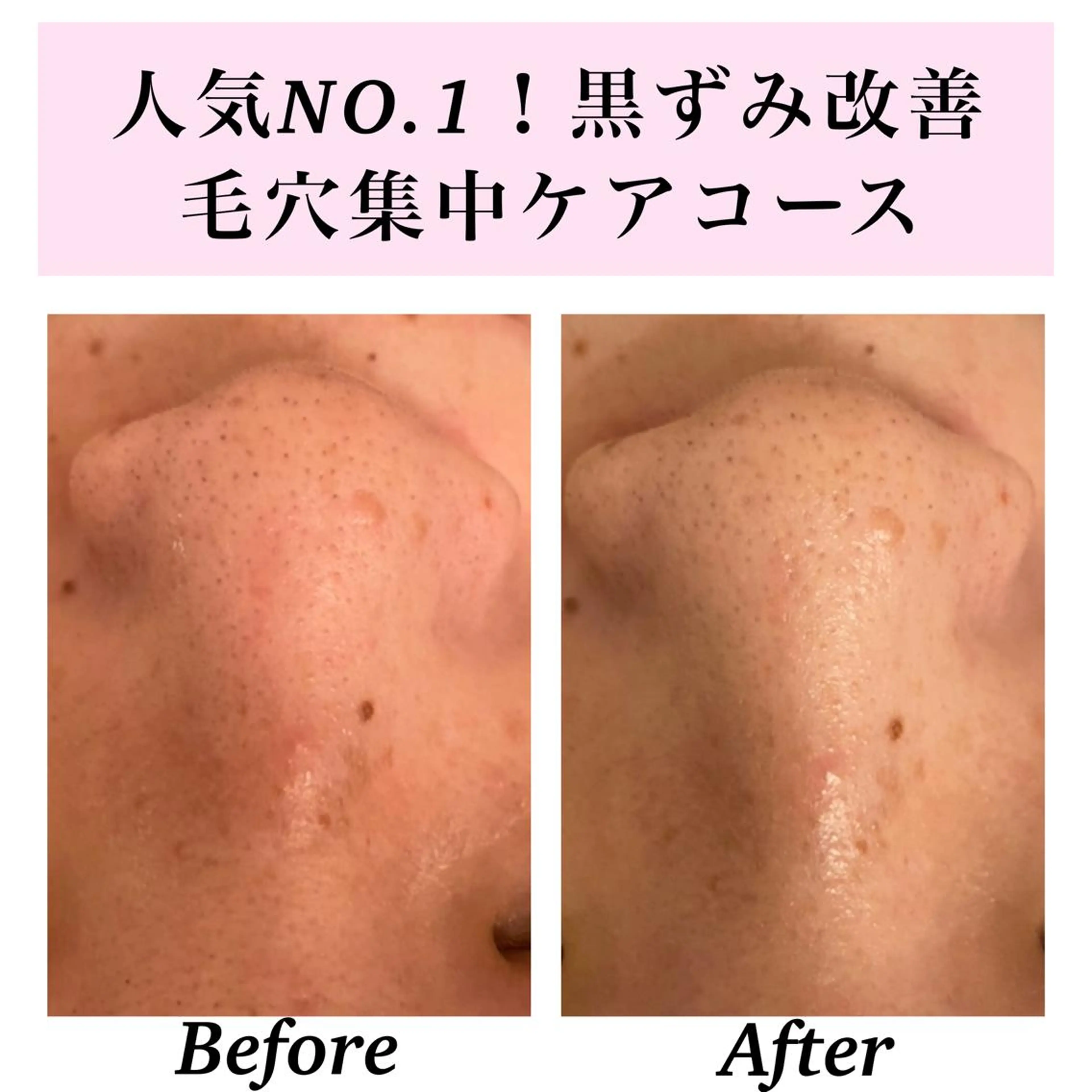 エステ リラク Bellesthe (ベルエステ)のエステ・リラクイメージ