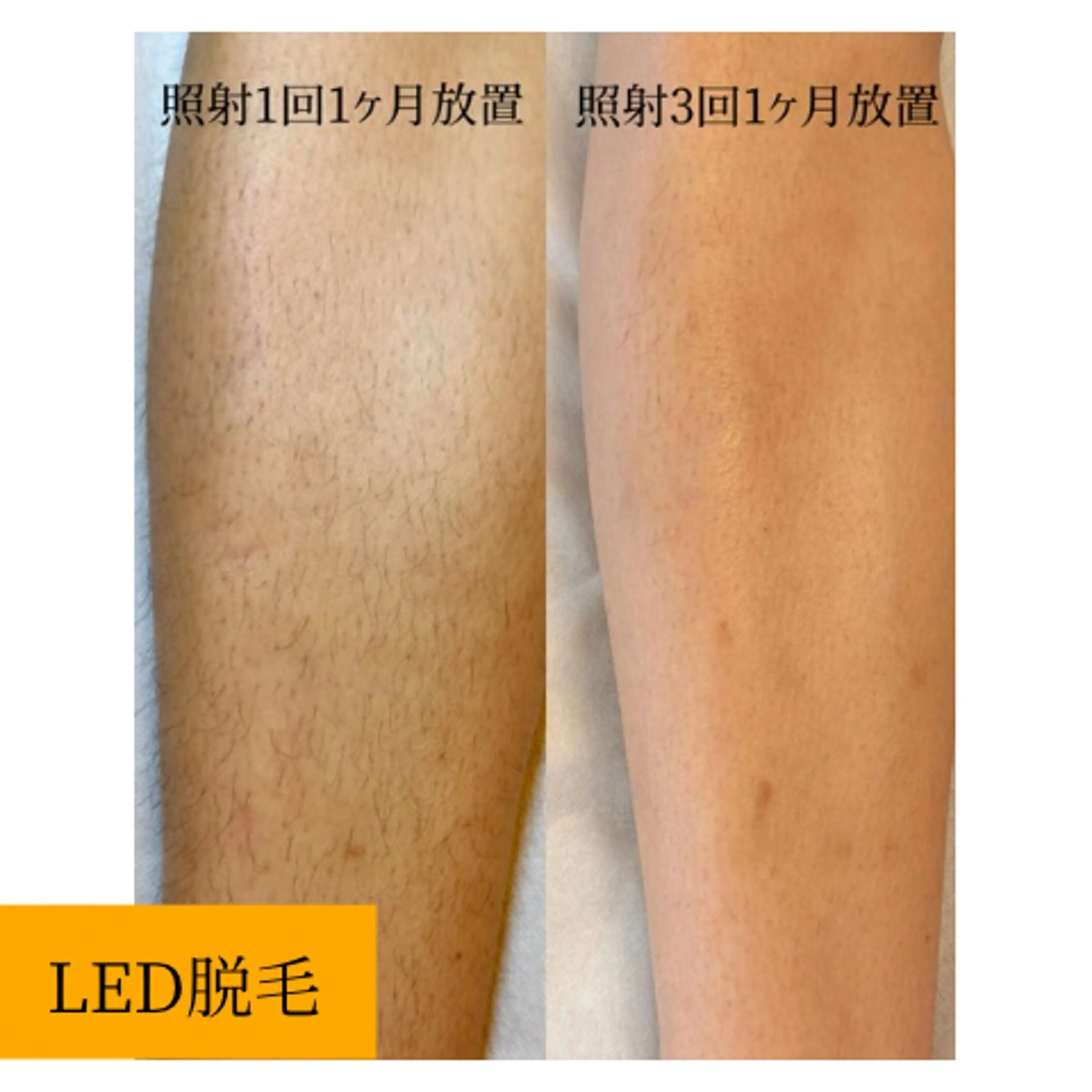 viv　春日部/豊春 megumiのエステ・リラクイメージ